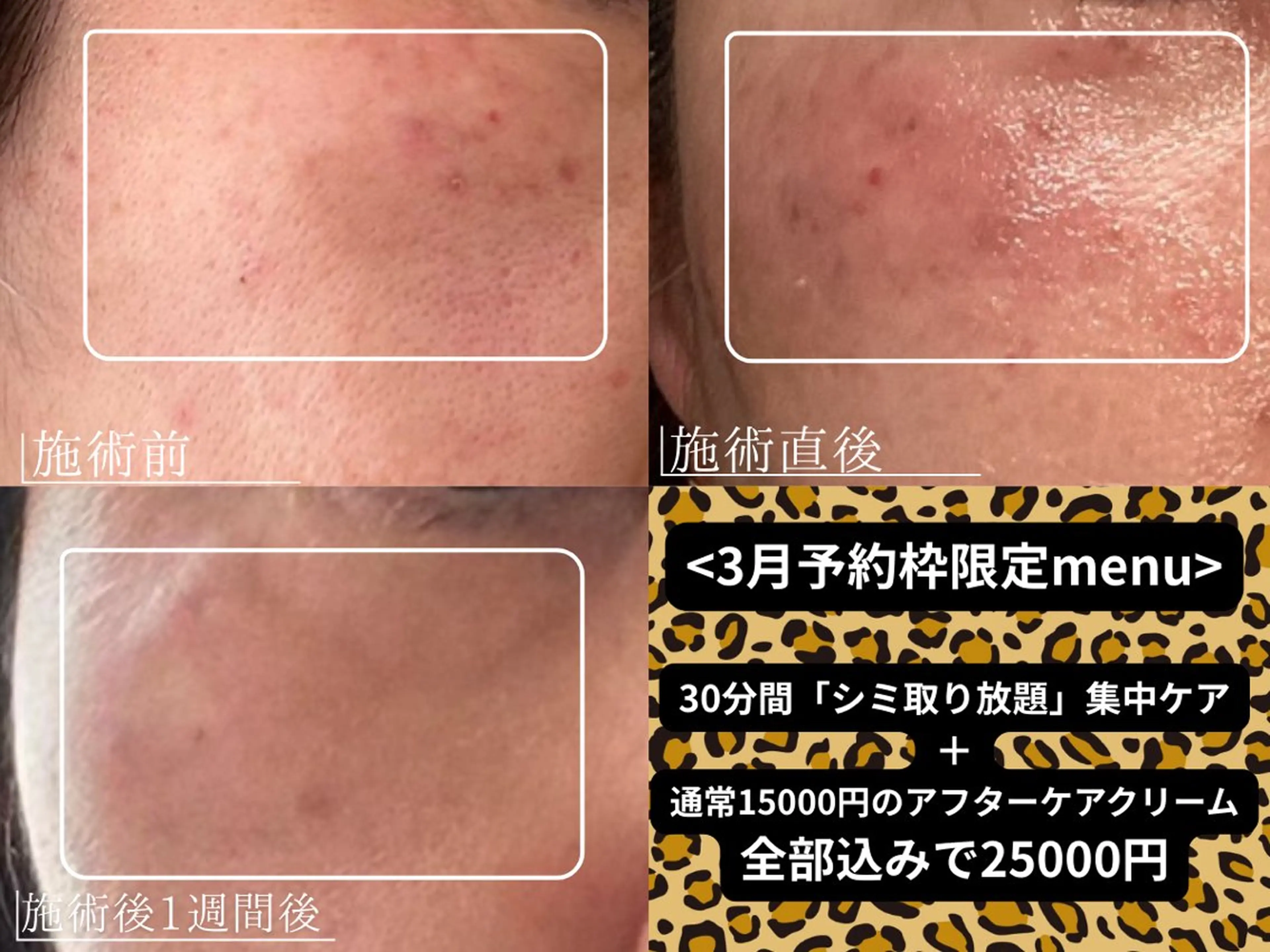 サロンマミ MAMIのエステ・リラクイメージ