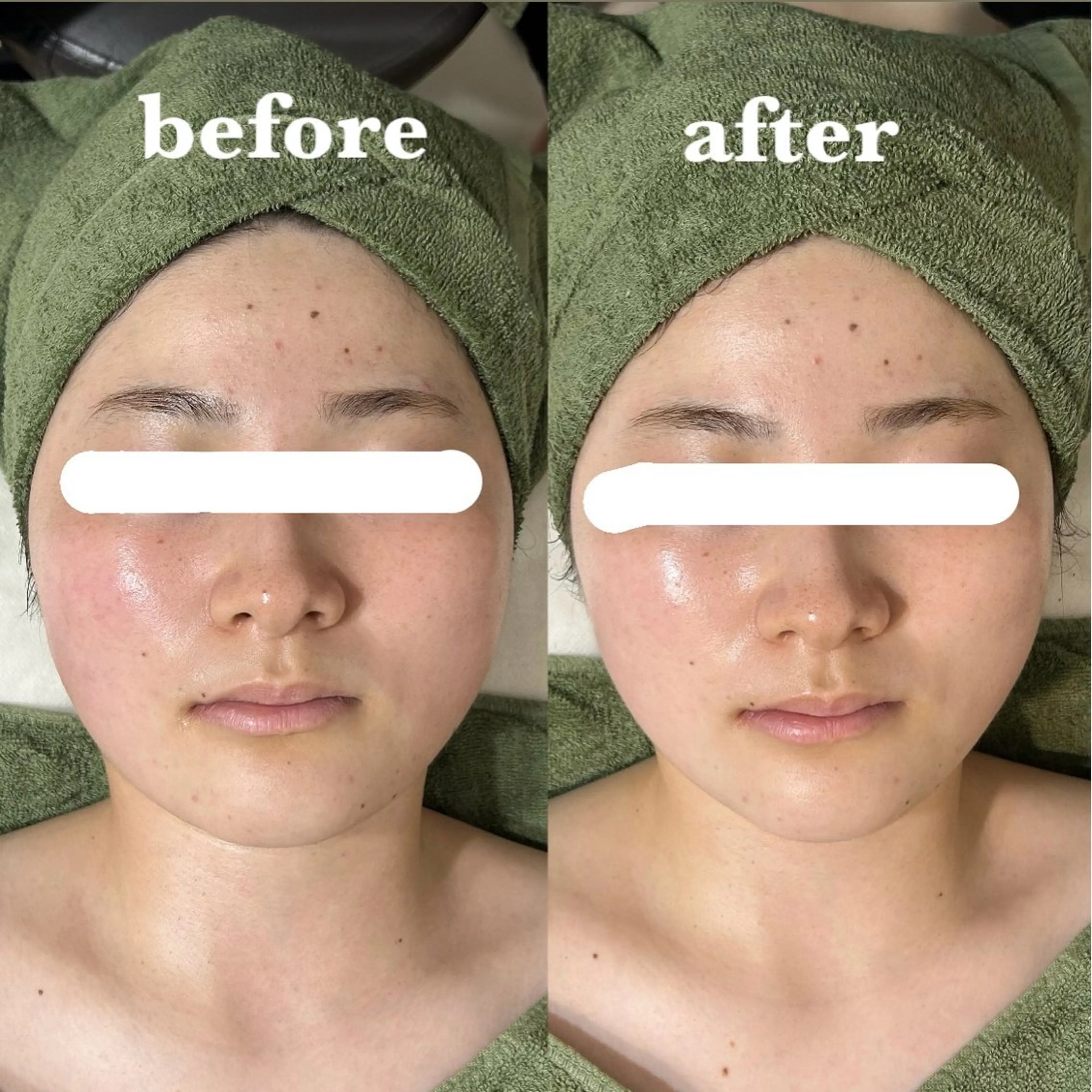 メンズ エステ リラク 【肌質改善サロン】 リーフィアのエステ・リラクイメージ