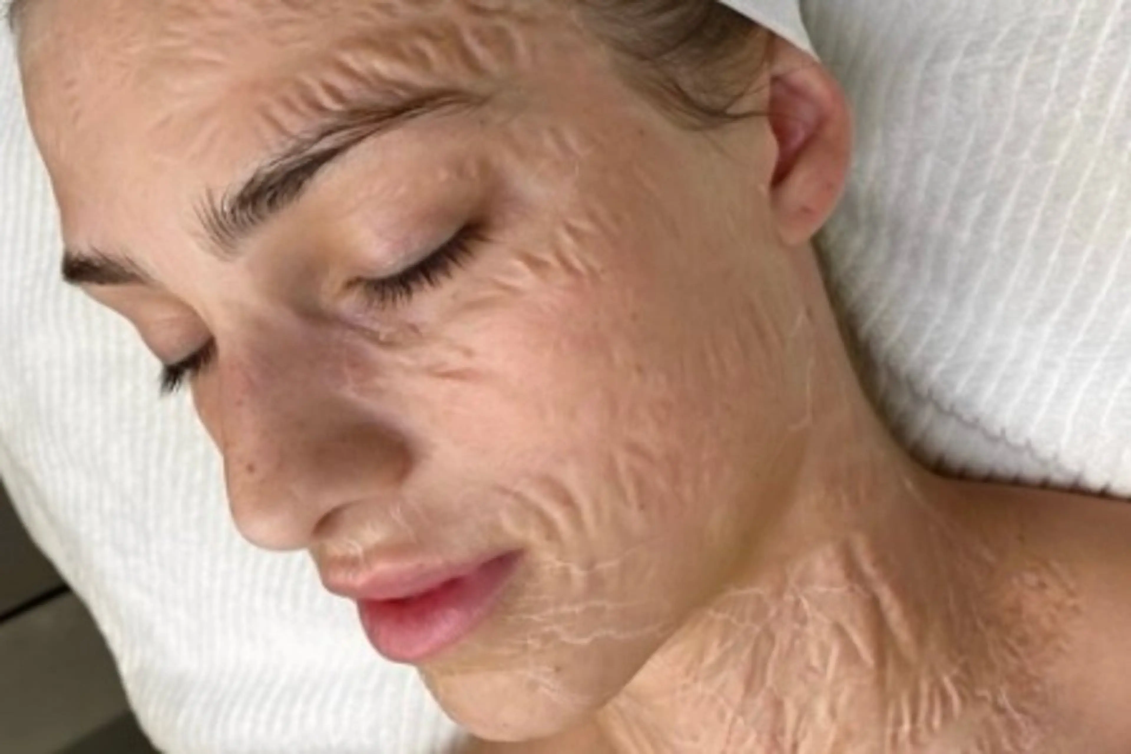 ゾンビマスク🧟♀️✨️毛穴引き締め👃ハリツヤお肌に🫧(施術時間約60分)の写真