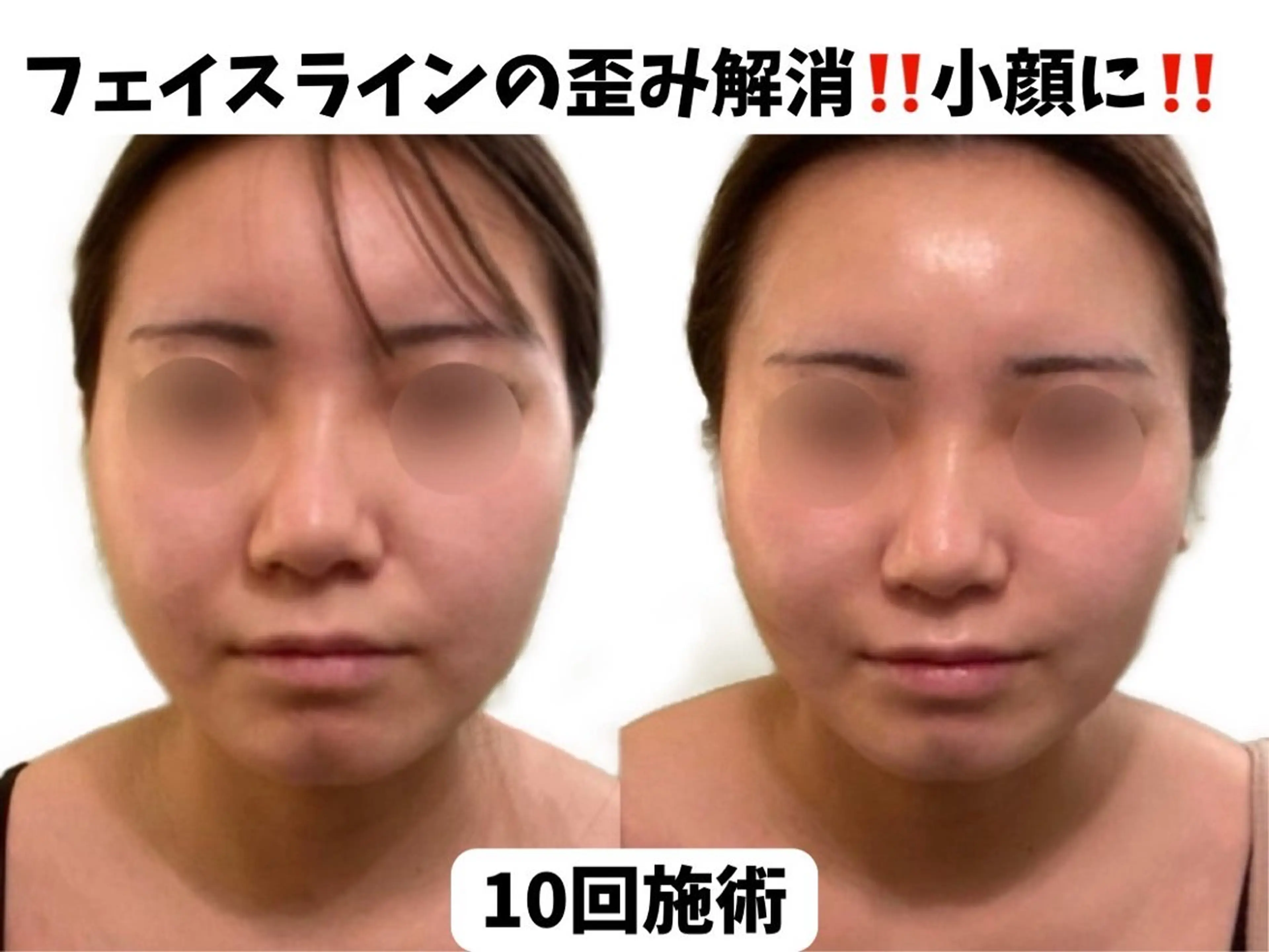 サロンハート浦和店所属・痩身小顔サロンハート 浦和店のエステ・リラクイメージ