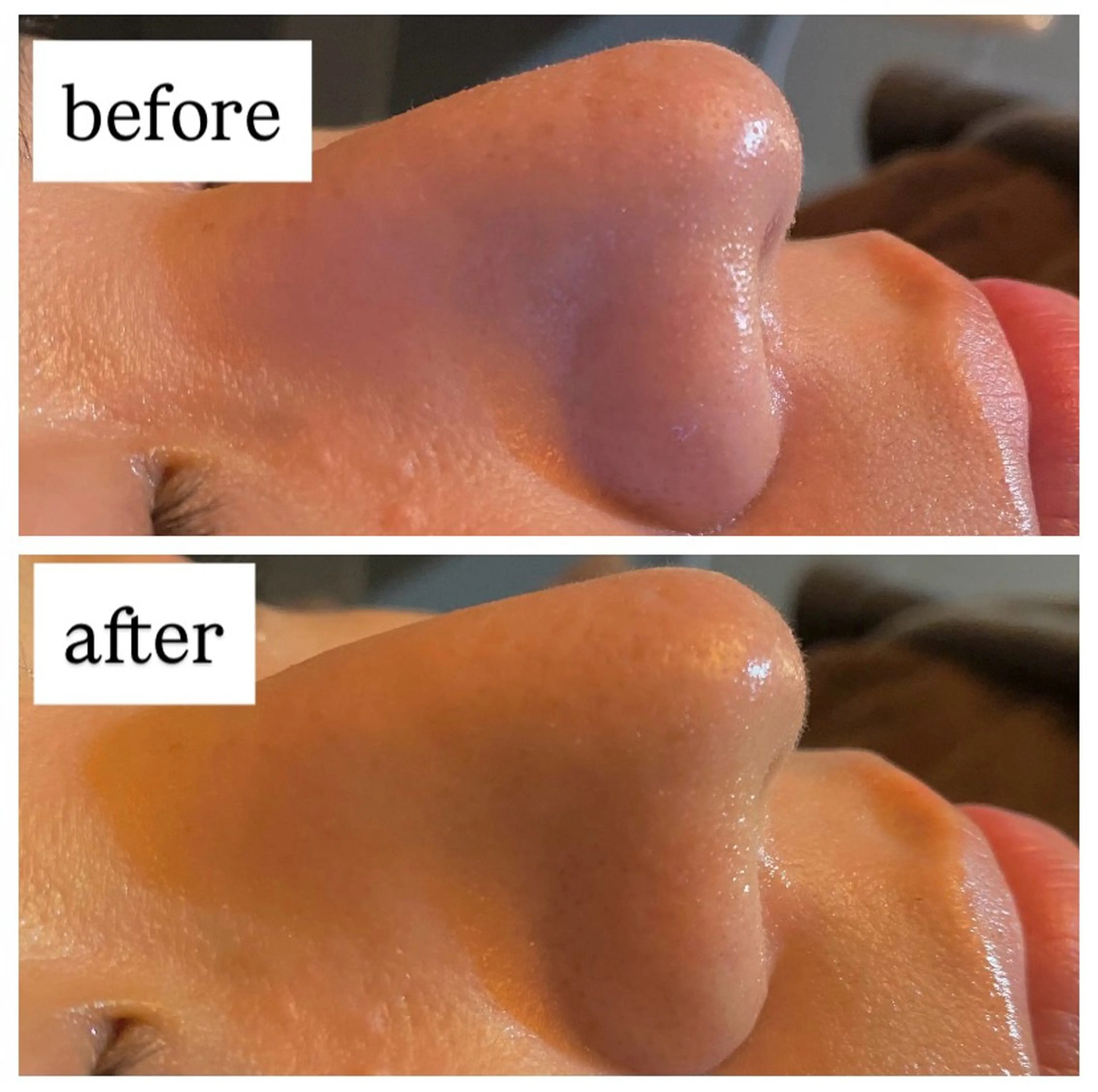 エステ 肌質改善専門 ハーブ /毛穴洗浄 リエイトのエステ・リラクイメージ