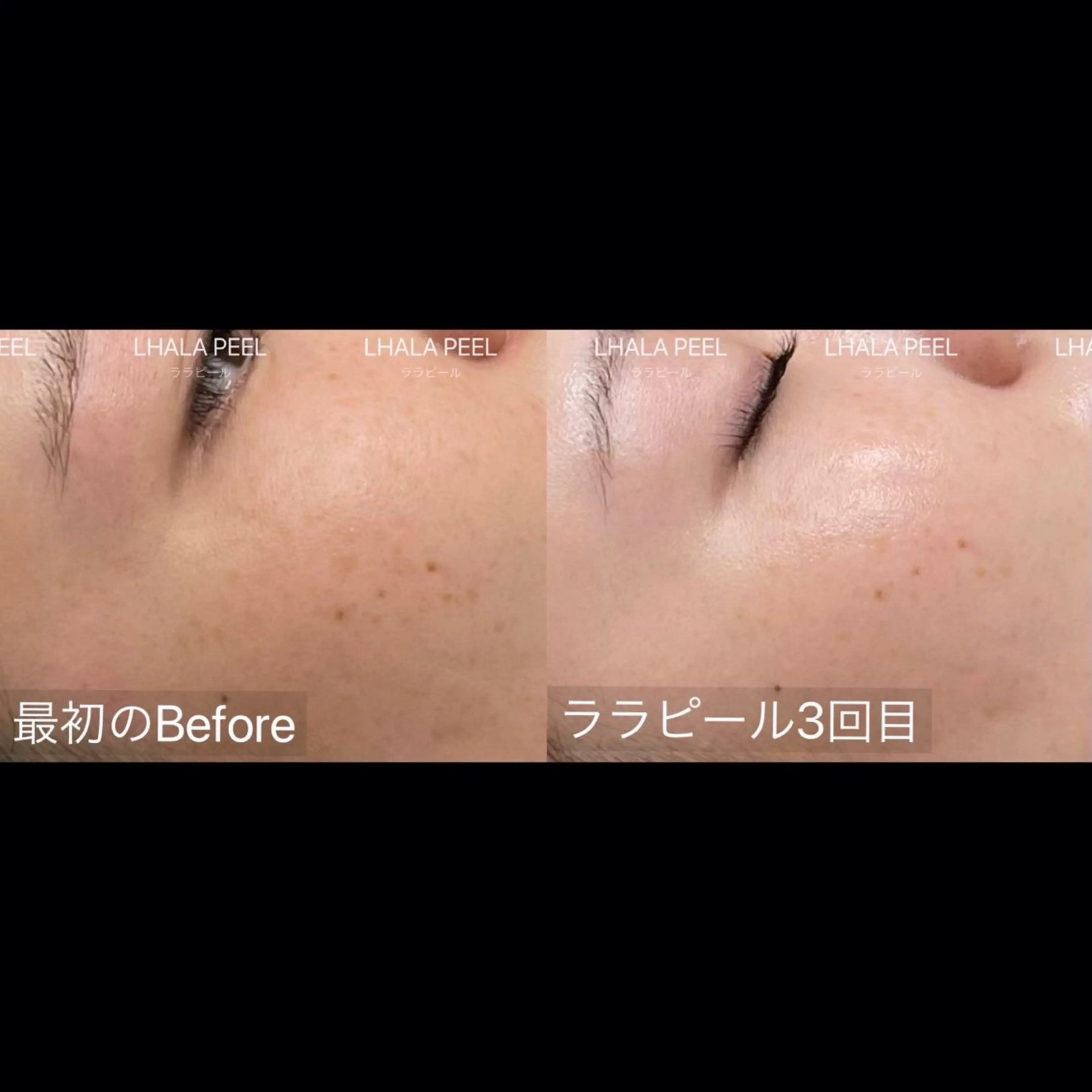 ナチュ眉🫧 minoriの眉毛・アイブロウイメージ