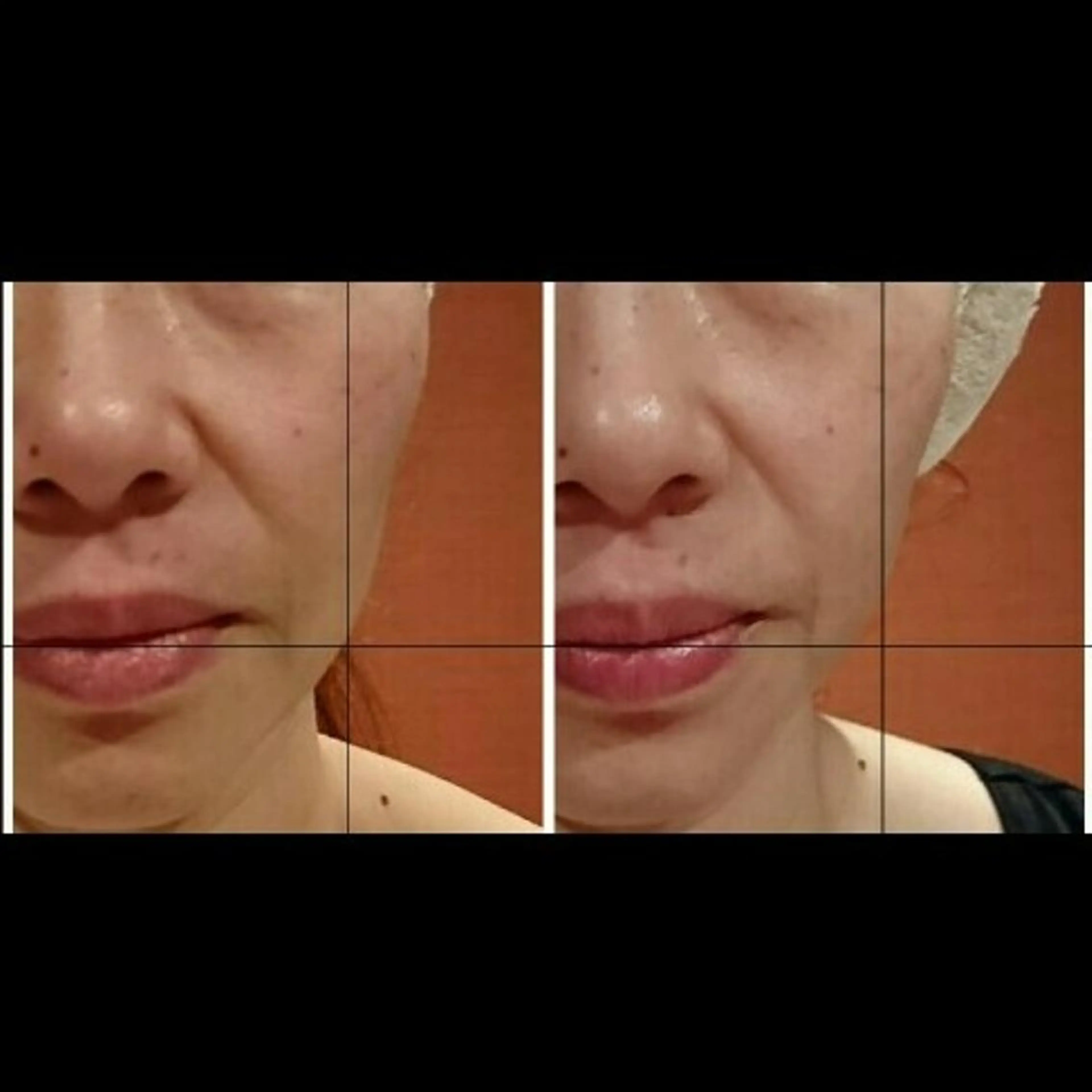 エステ リラク Nako  ﾅｺのエステ・リラクイメージ