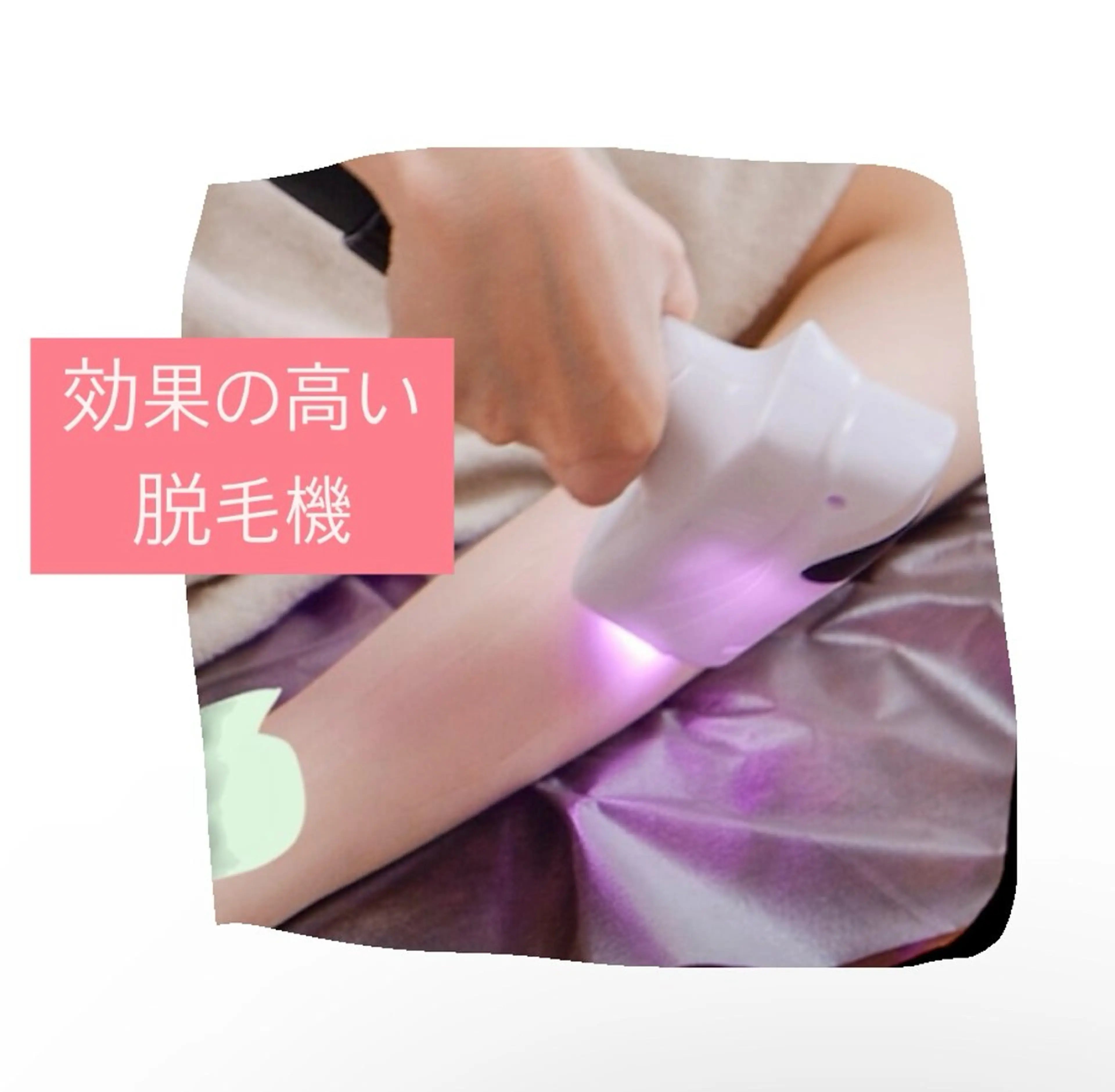 【ムレ・匂い・チクチク】デリケートVIO美肌脱毛❣️皆んな始めてる！自己処理卒業✨低刺激で優しい♡痛みが苦手でも大丈夫◎の写真