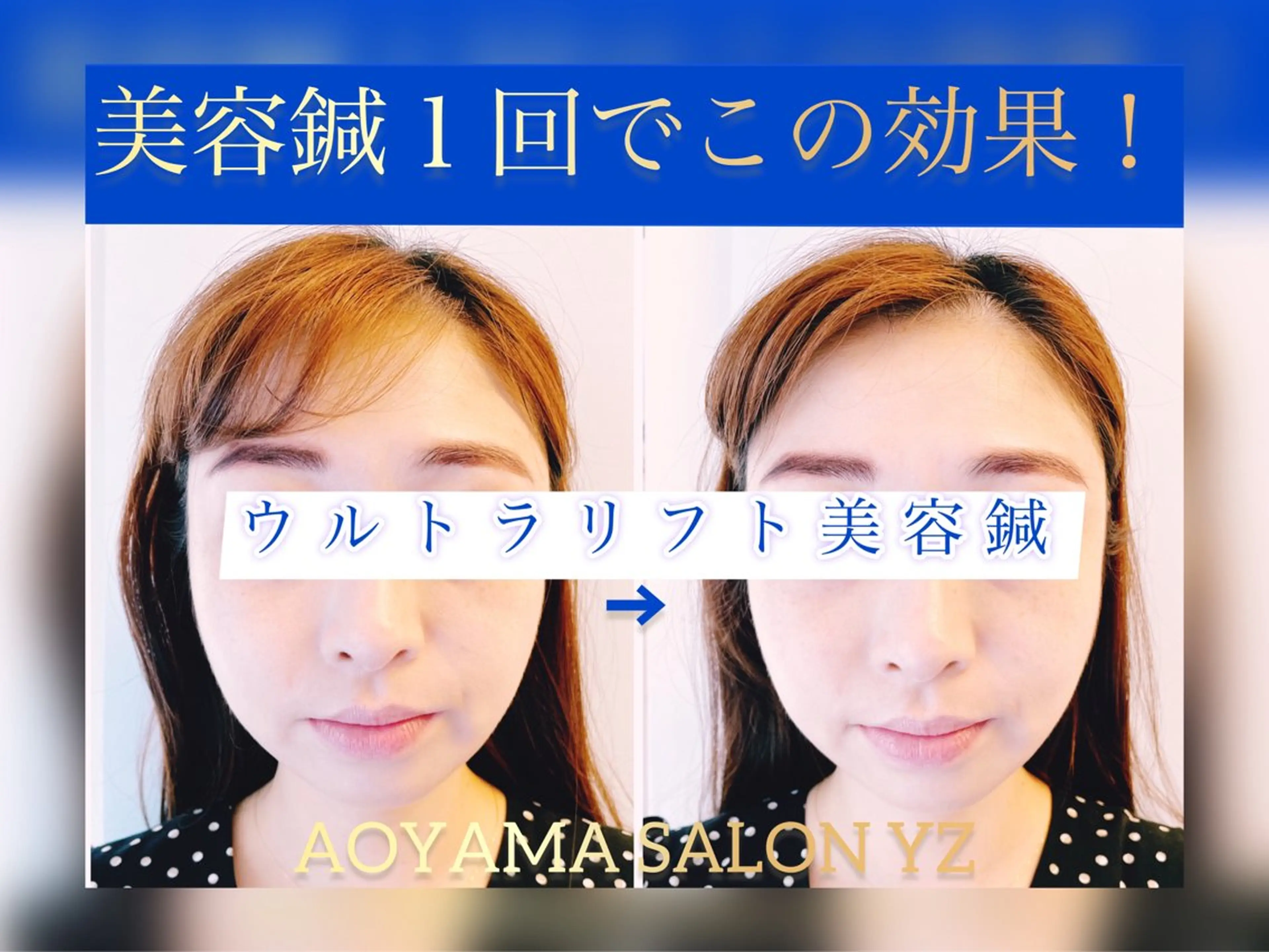 エステ リラク 小顔美容鍼専門サロン 渋谷YZのエステ・リラクイメージ