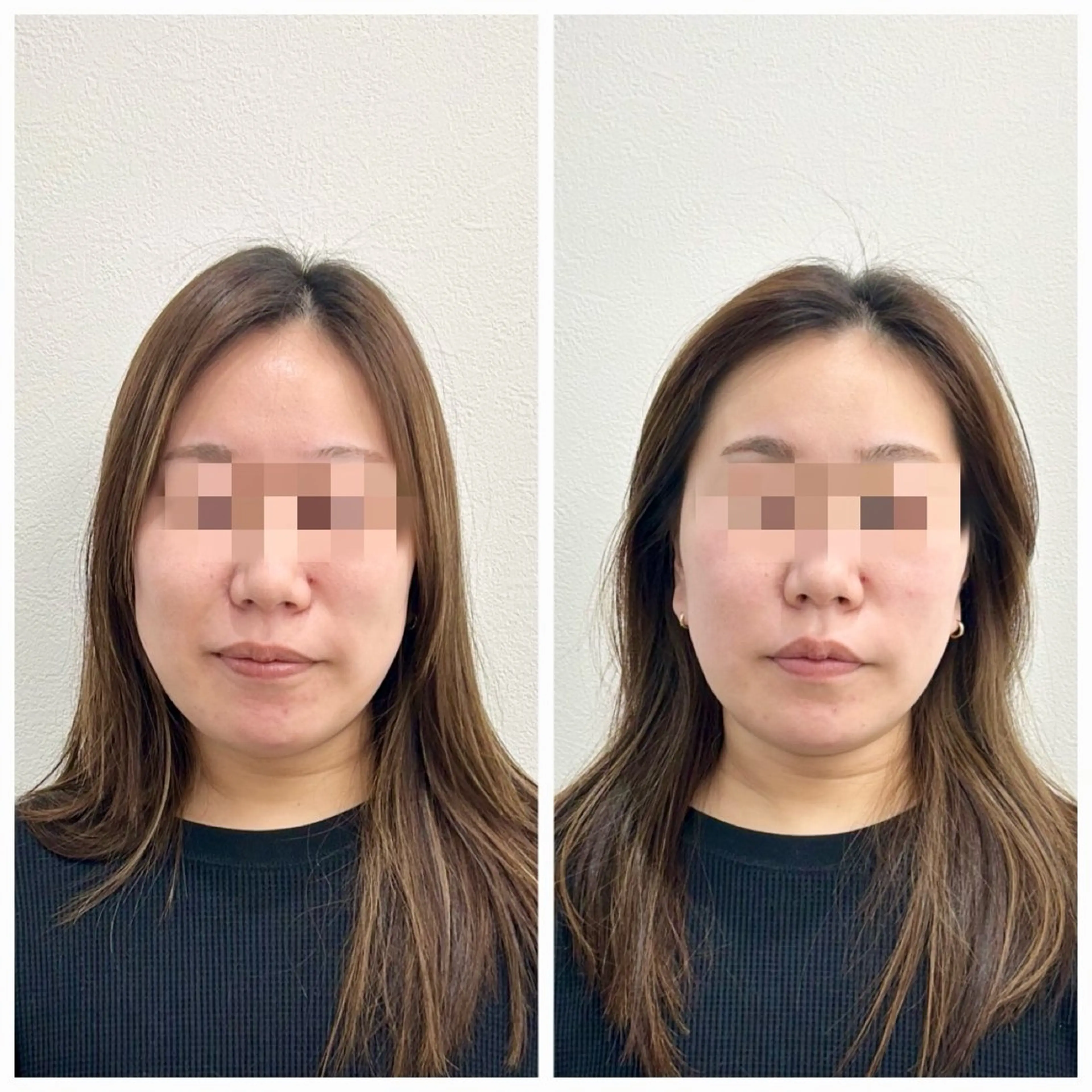 エステ リラク 鍼灸HARIKARA所属・辛島 昴のエステ・リラクイメージ