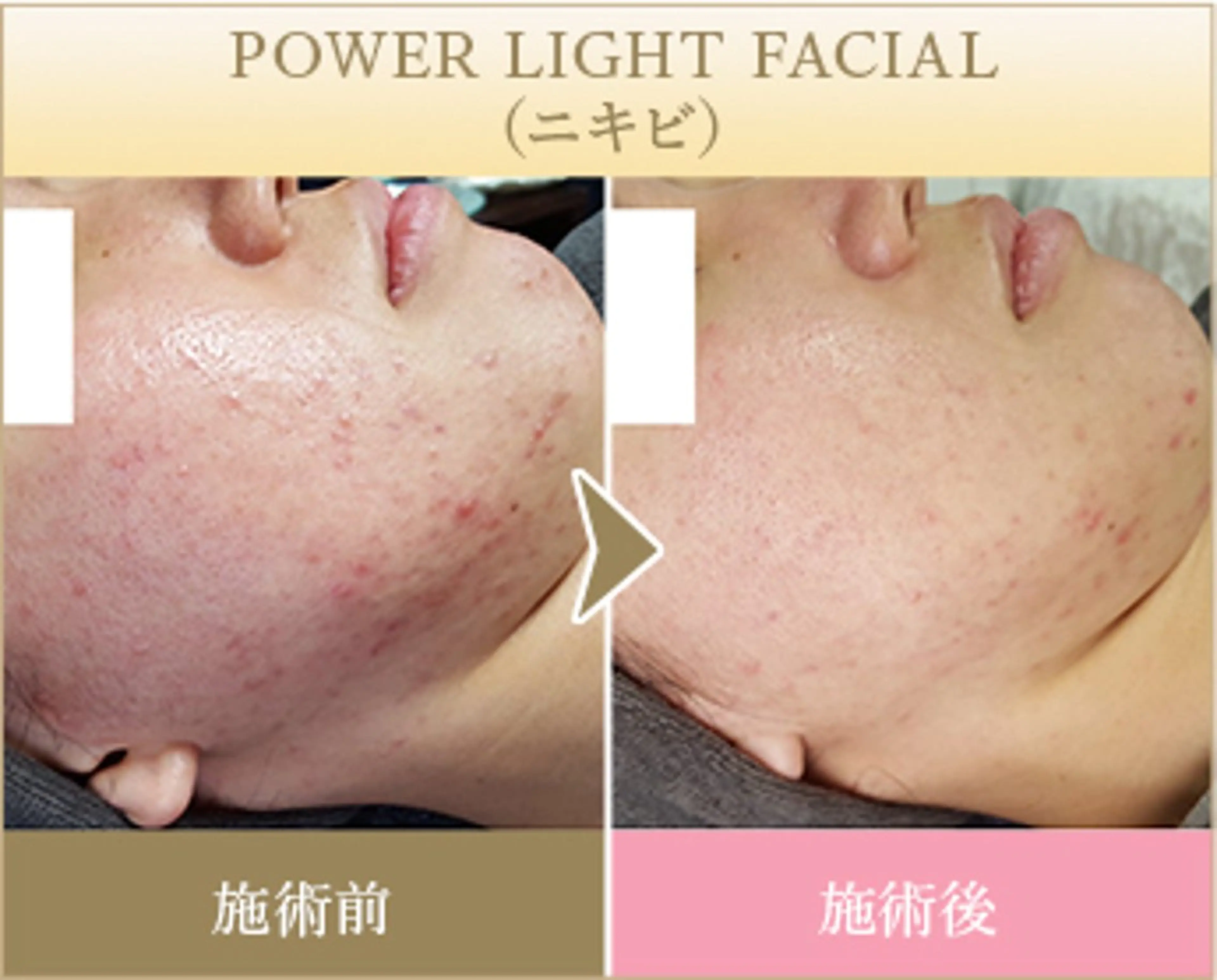 ˚⟡ suwan .˚⟡のエステ・リラクイメージ