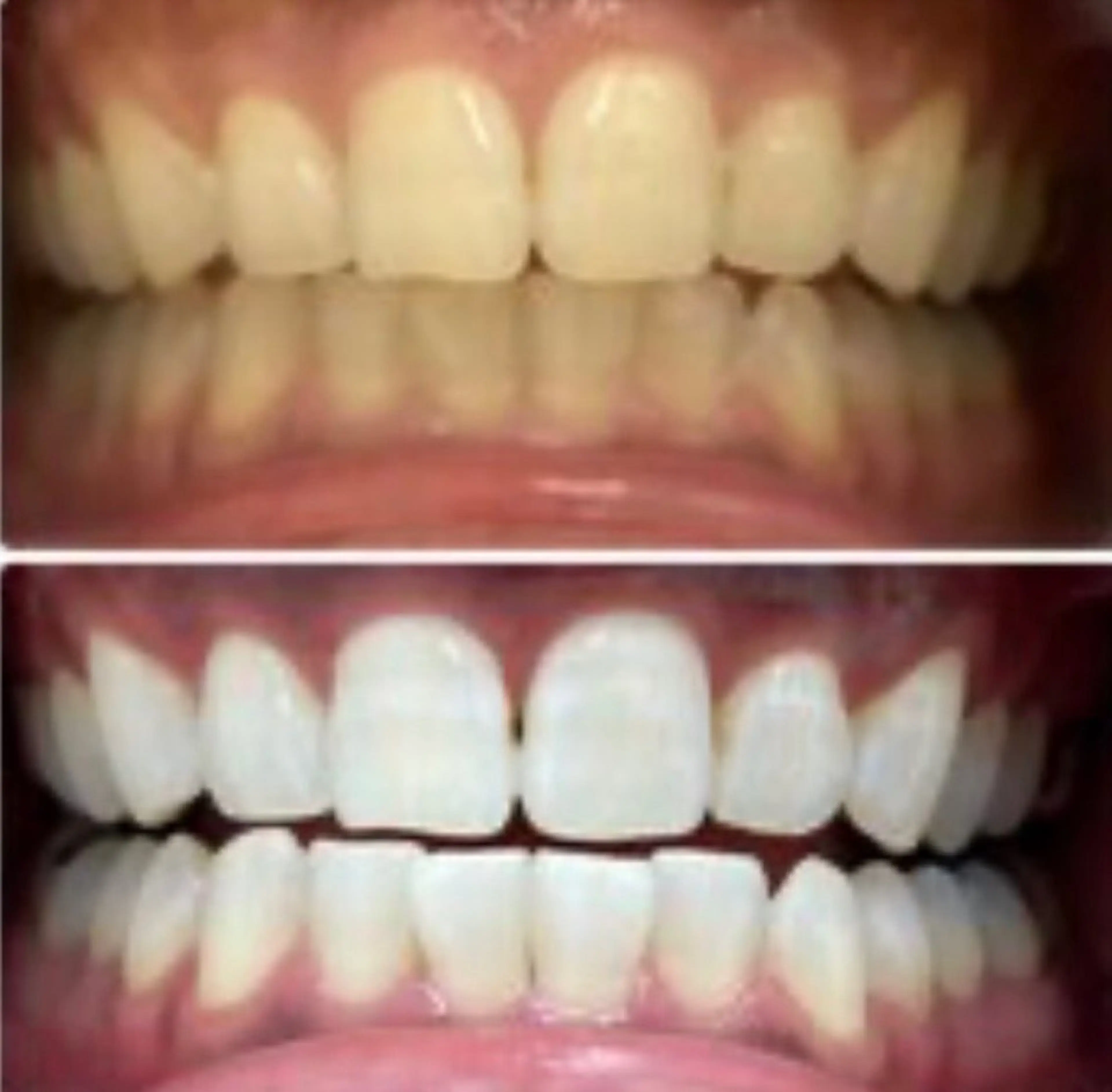 エステ エクシアホワイト 立川南口のエステ・リラクイメージ