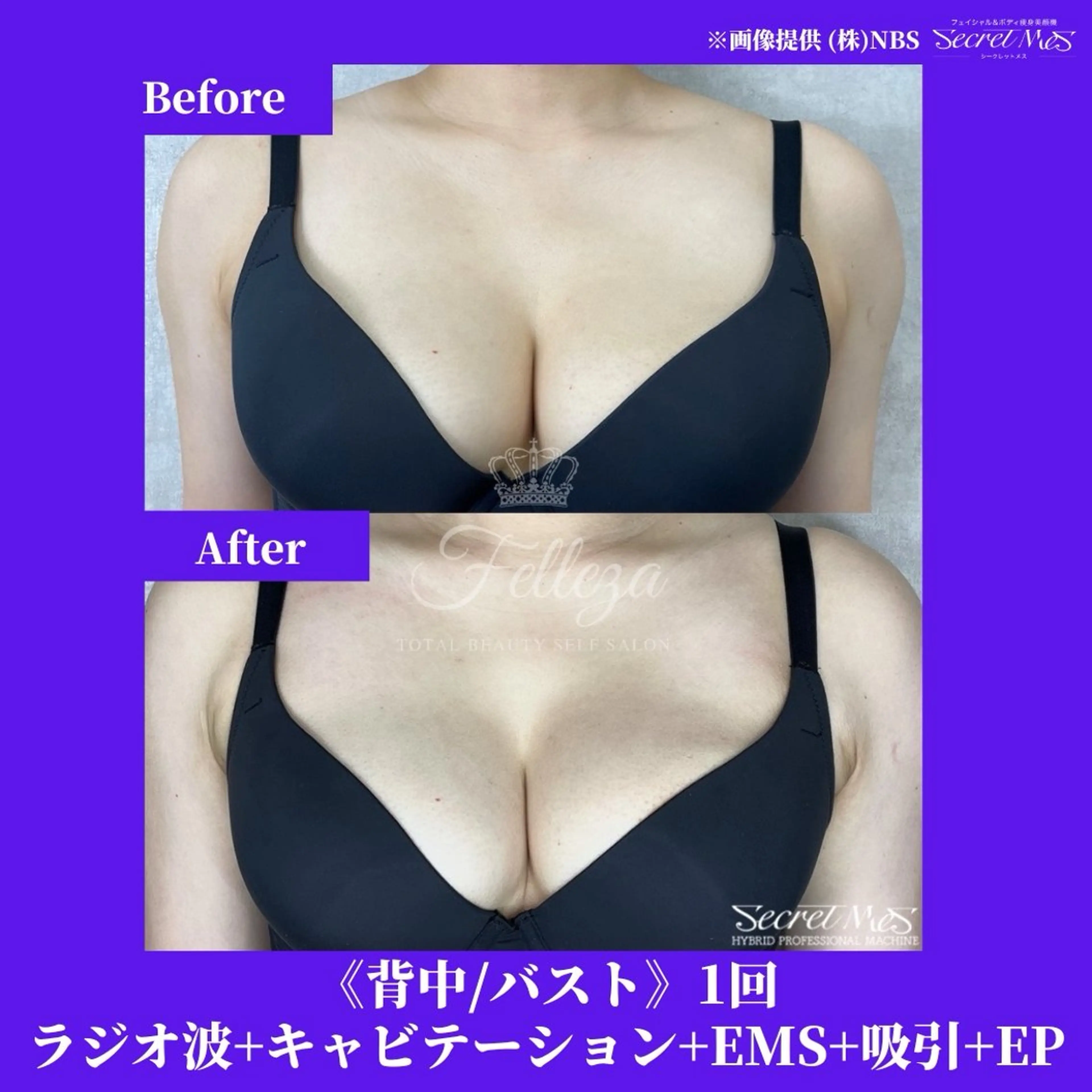 メンズ 有人型セルフサロン 脱毛／痩身／美顔のその他イメージ