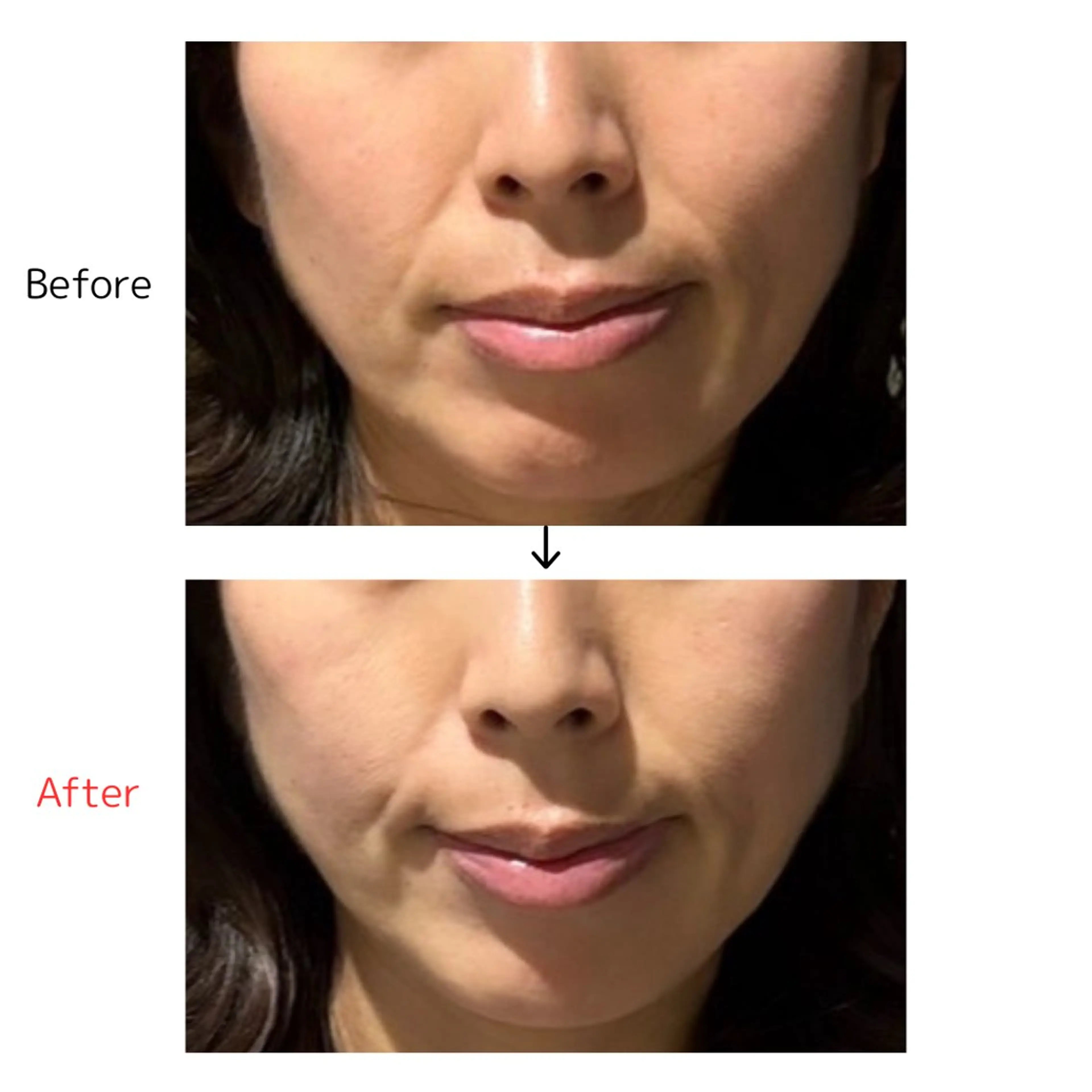 あさば整骨院 柏の葉店 × メディカルトレーニングジム Peace所属・健康×美容鍼灸院 あさば整骨院柏の葉院のその他イメージ