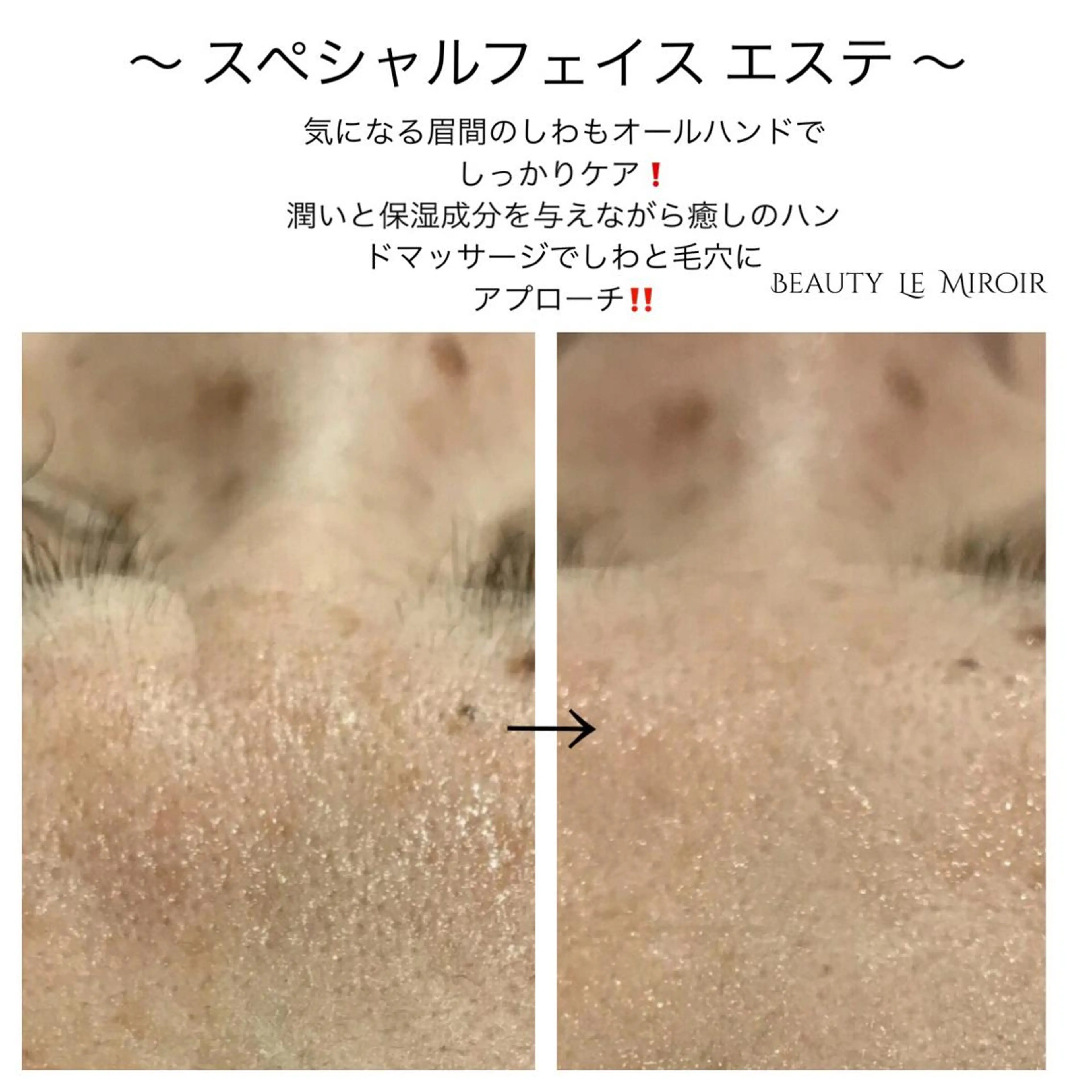 ビューティー ミロワールのエステ・リラクイメージ