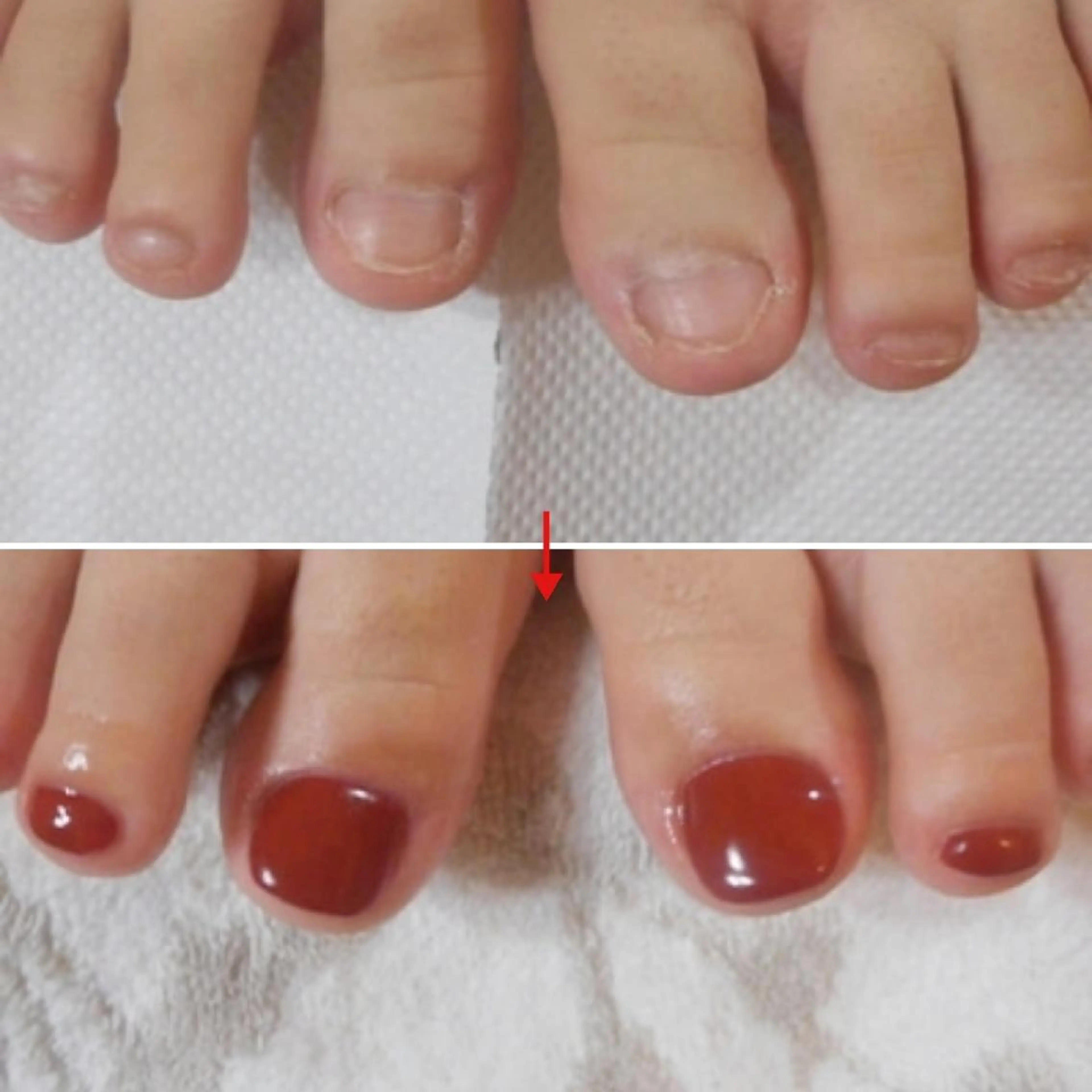 ネイル フットネイル ネイルサロンアリューム所属・ネイルサロン アリュームのネイルデザイン