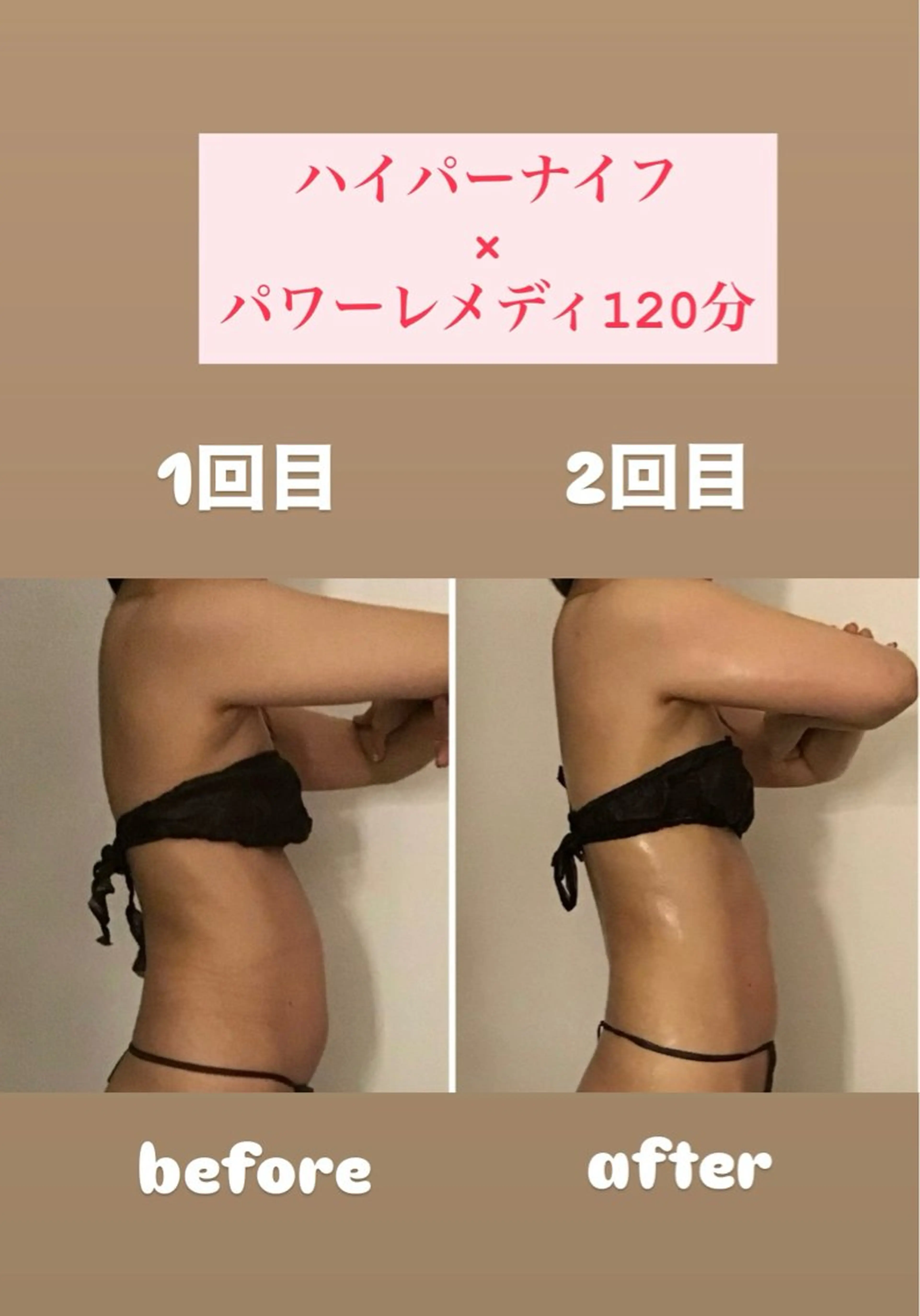 エステ リラク BELLEFINE 💕痩身・小顔・脱毛のエステ・リラクイメージ