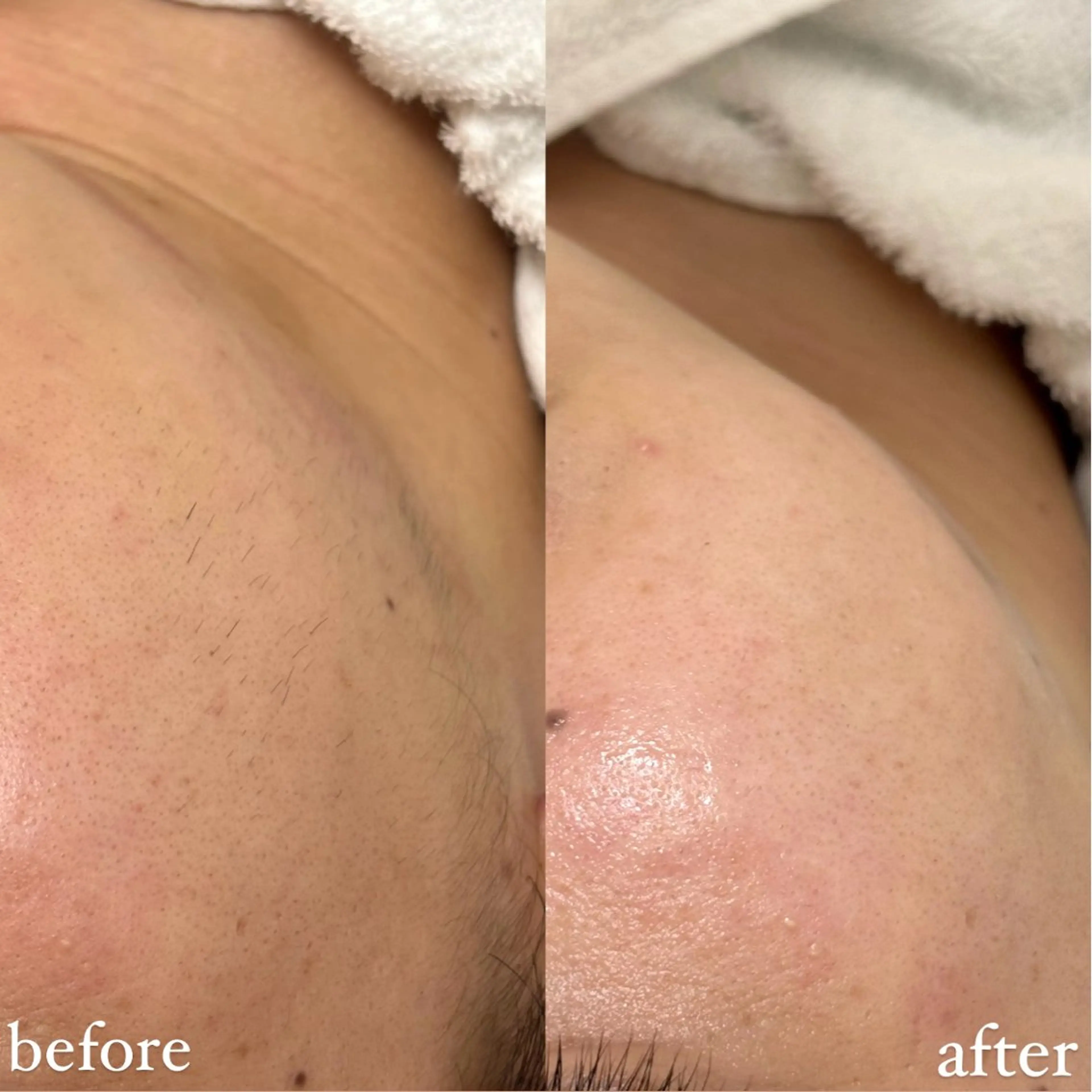 女性専門お顔剃り sunraineのエステ・リラクイメージ