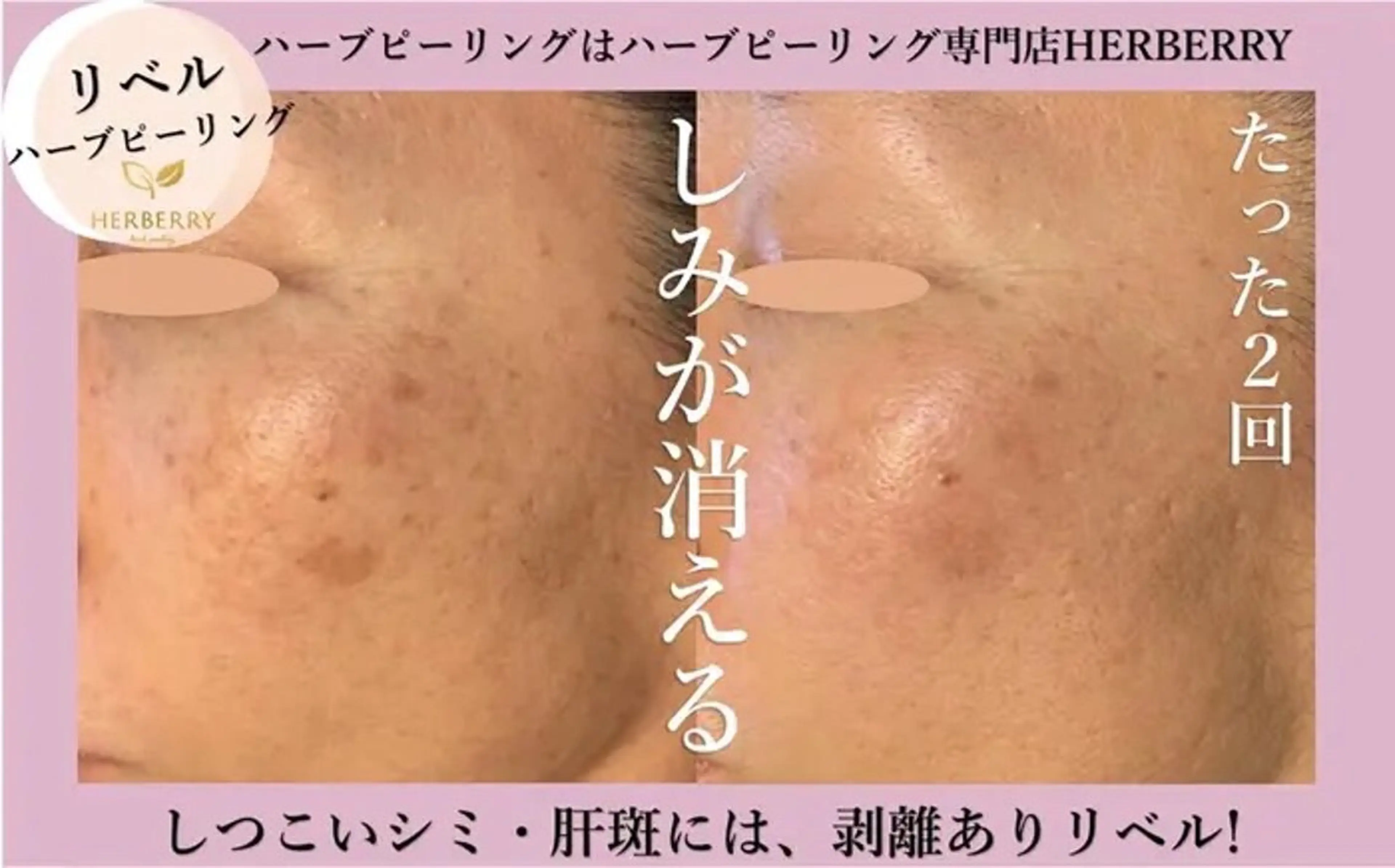 ハーブピーリング専門店HERBERRY難波心斎橋店所属・ハーブピーリング専門 HERBERRY冨永のエステ・リラクイメージ