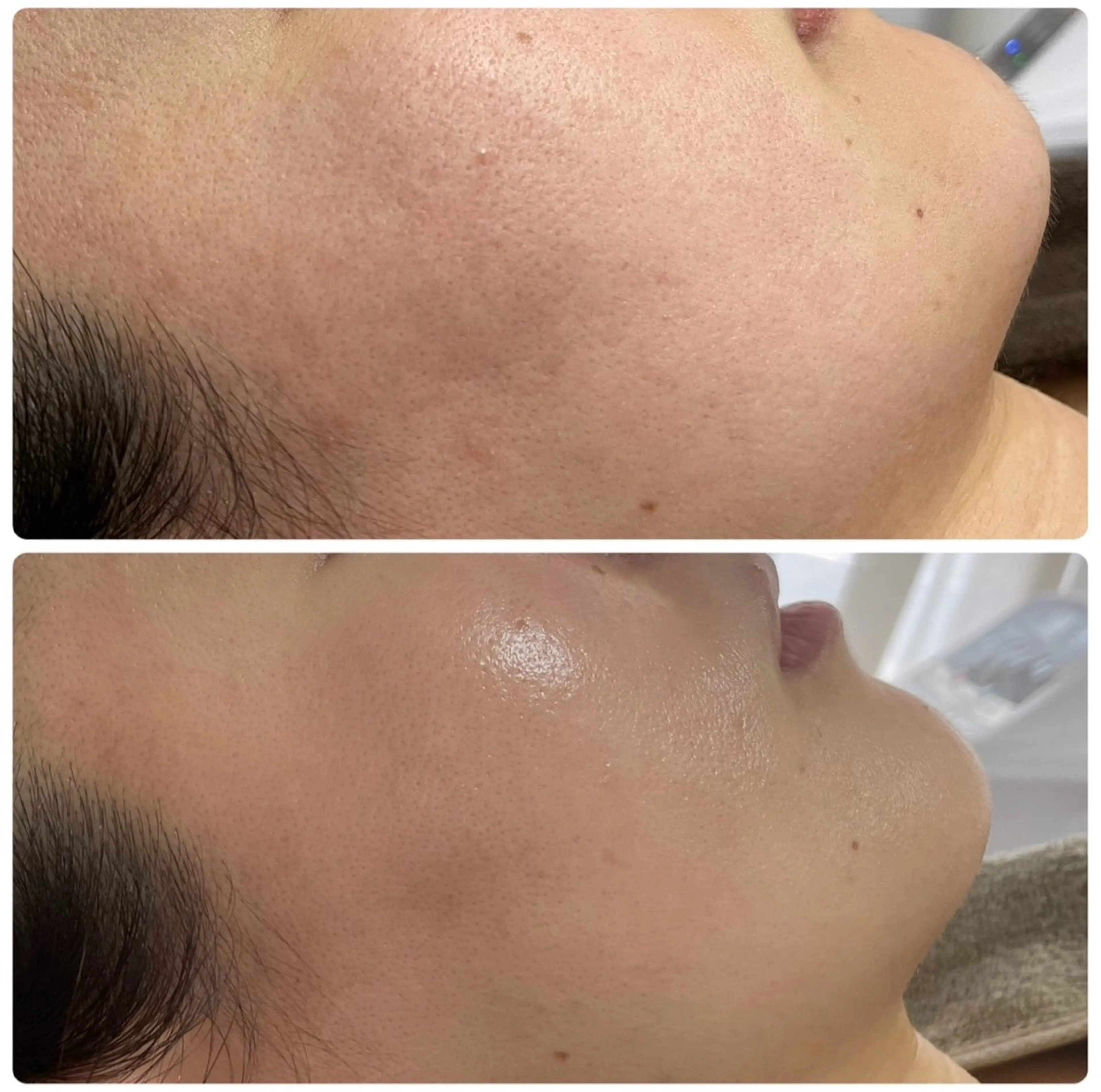 その他 Esthe salon Blanche(エステサロンブランシュ)所属・小顔リフトアップ 美肌改善専門店のエステ・リラクイメージ