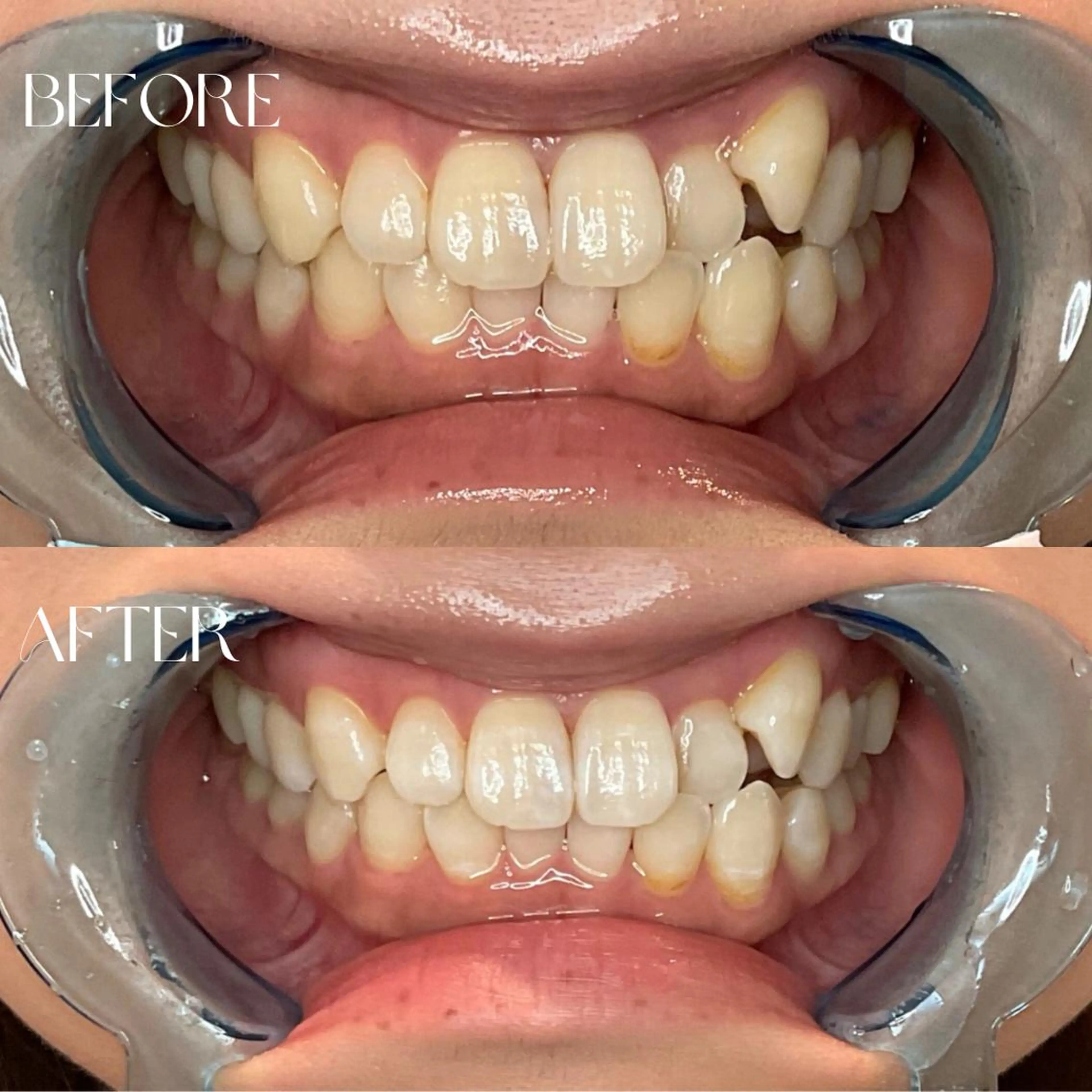 エステ B-st. 下北沢のその他イメージ