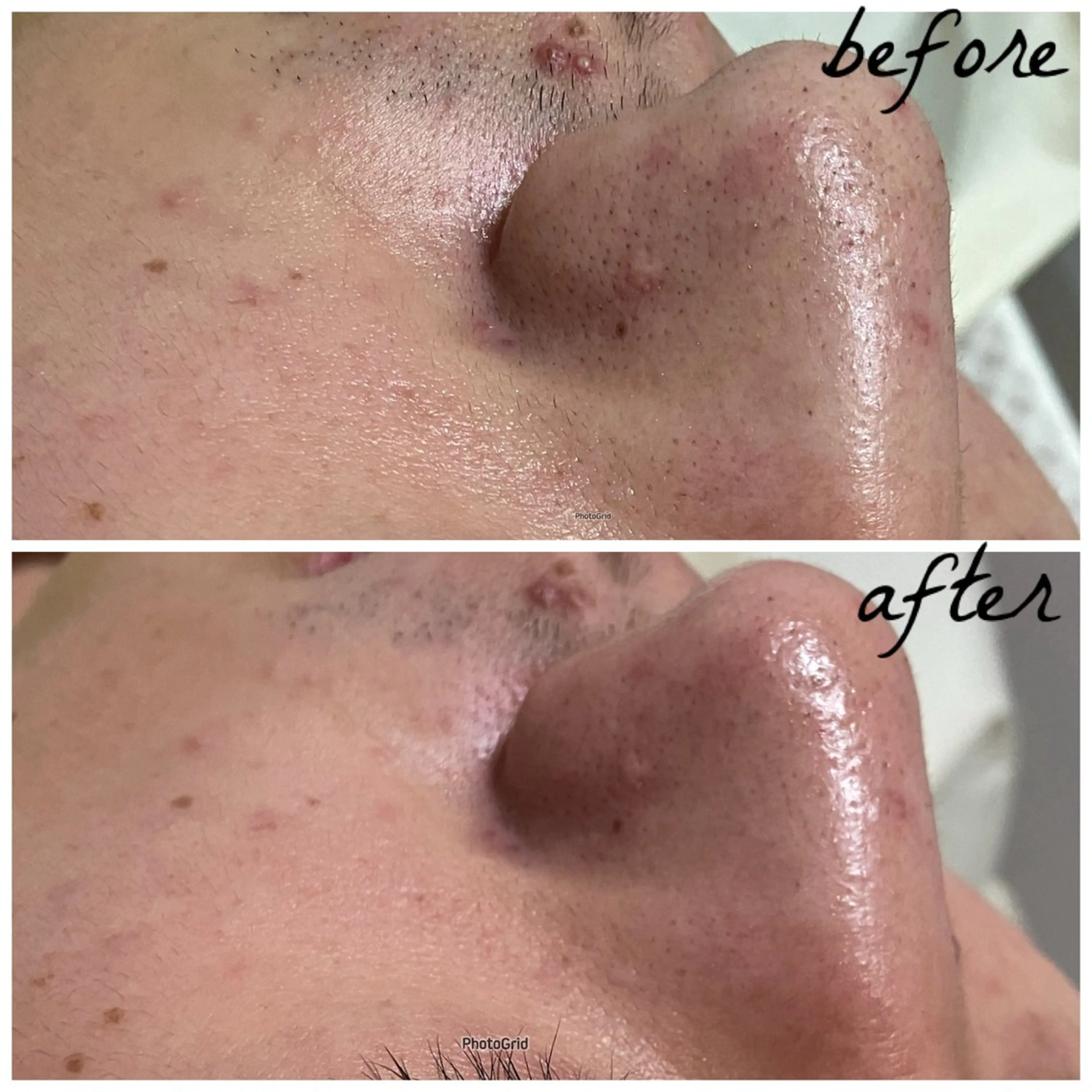 メンズ メナード岐阜茜部 杉浦のエステ・リラクイメージ