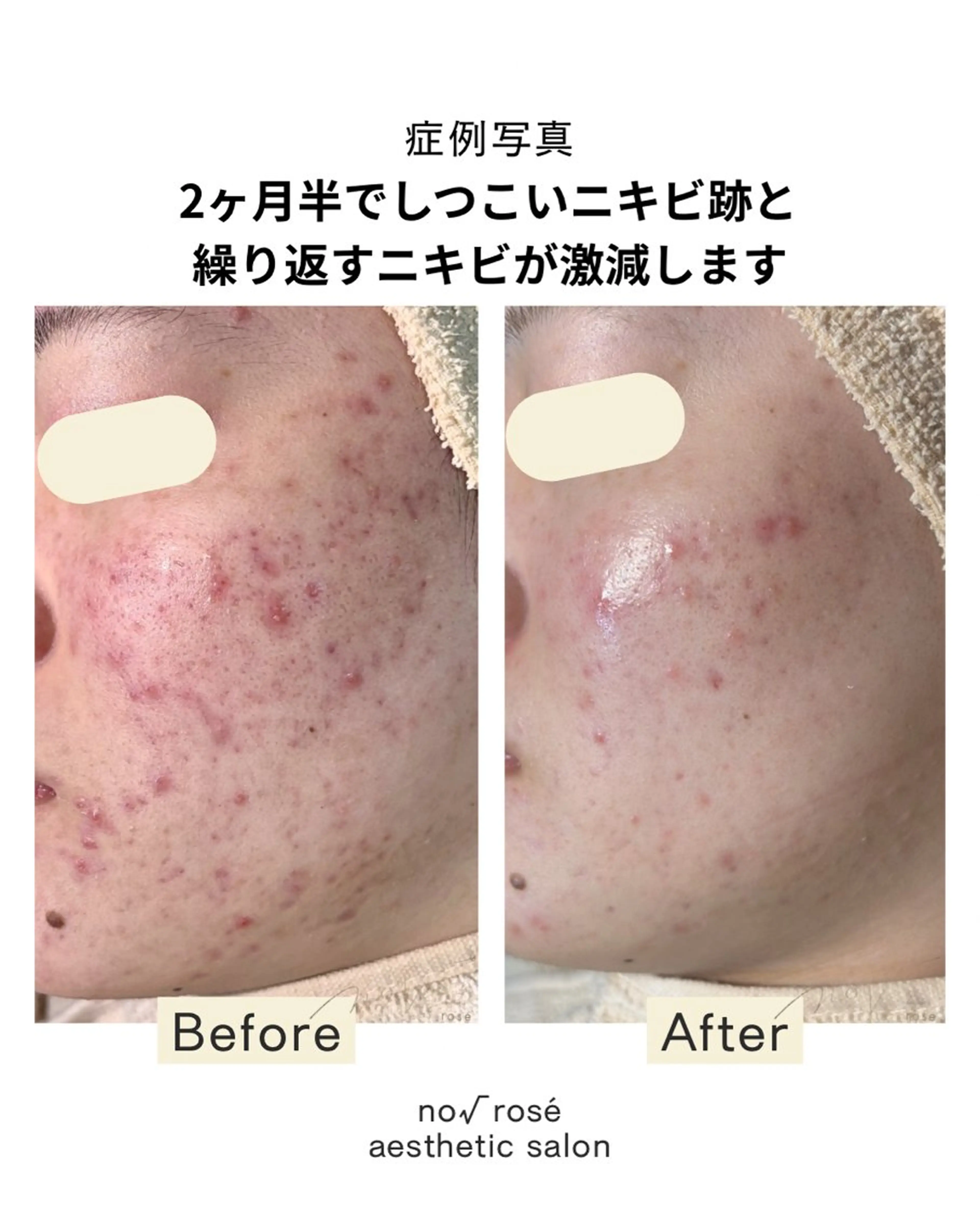 エステ ノールート ロゼのエステ・リラクイメージ