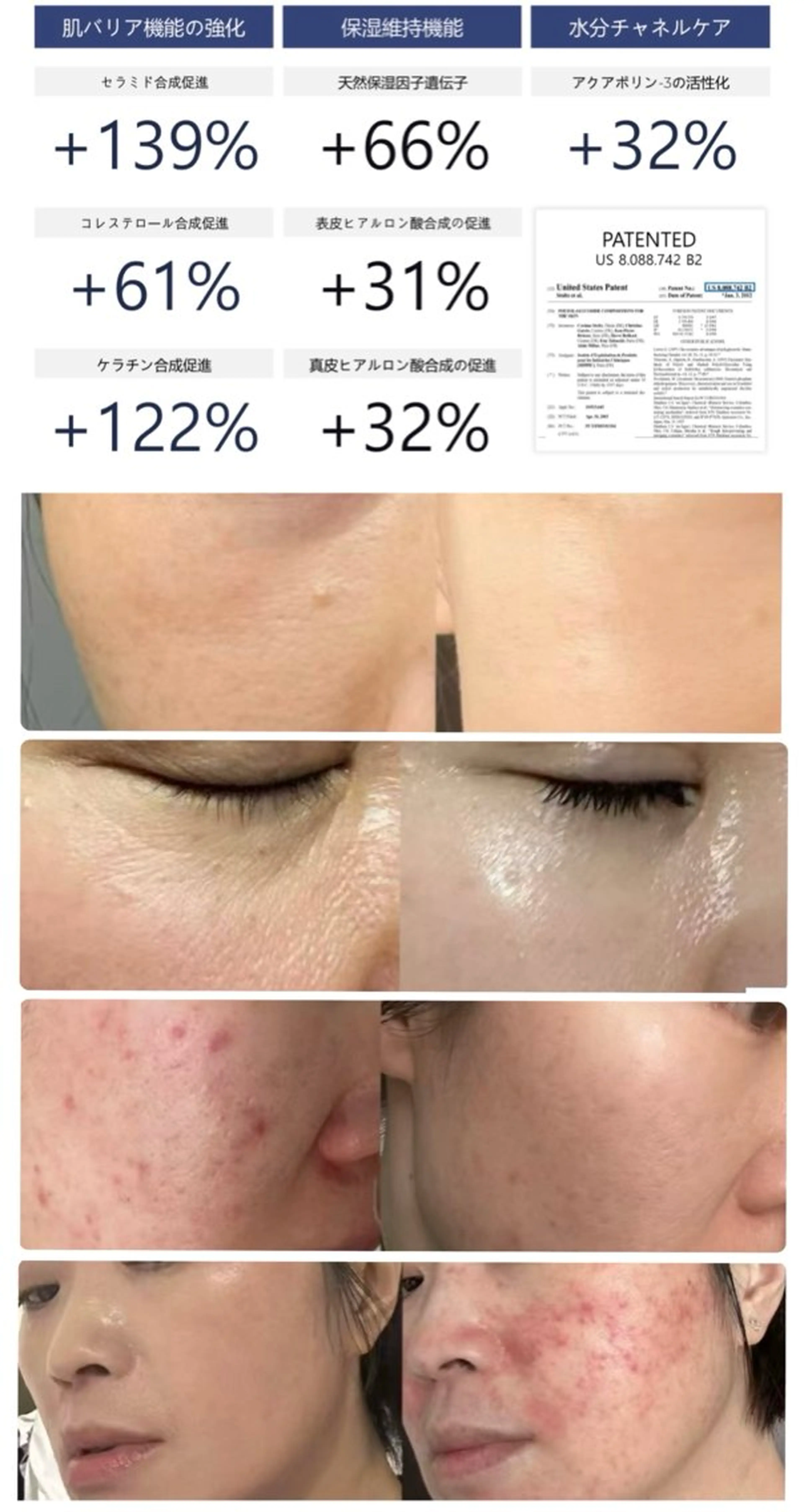 エステ エステサロン ラピュアビンのエステ・リラクイメージ