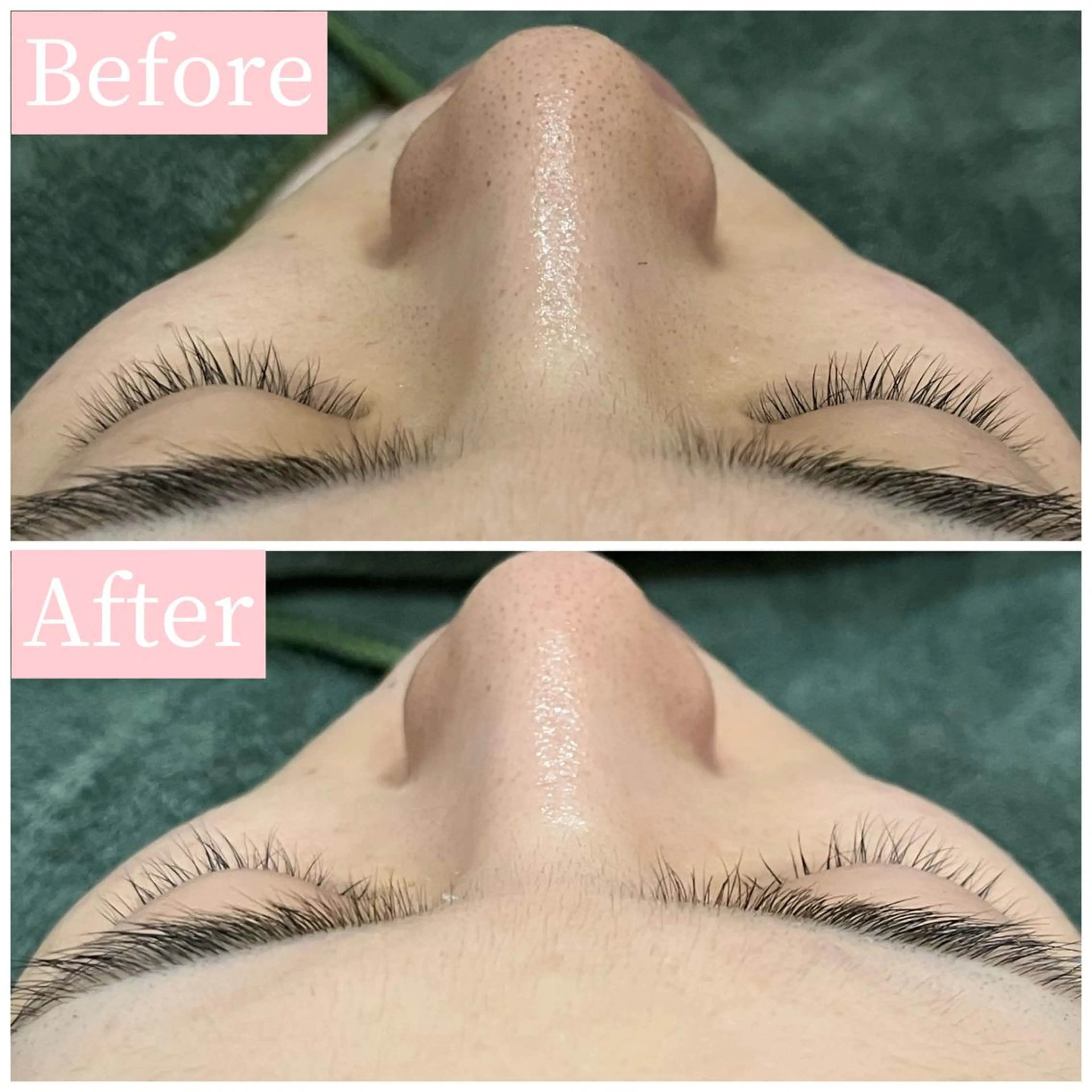 ハーブピーリング専門 muro.のエステ・リラクイメージ