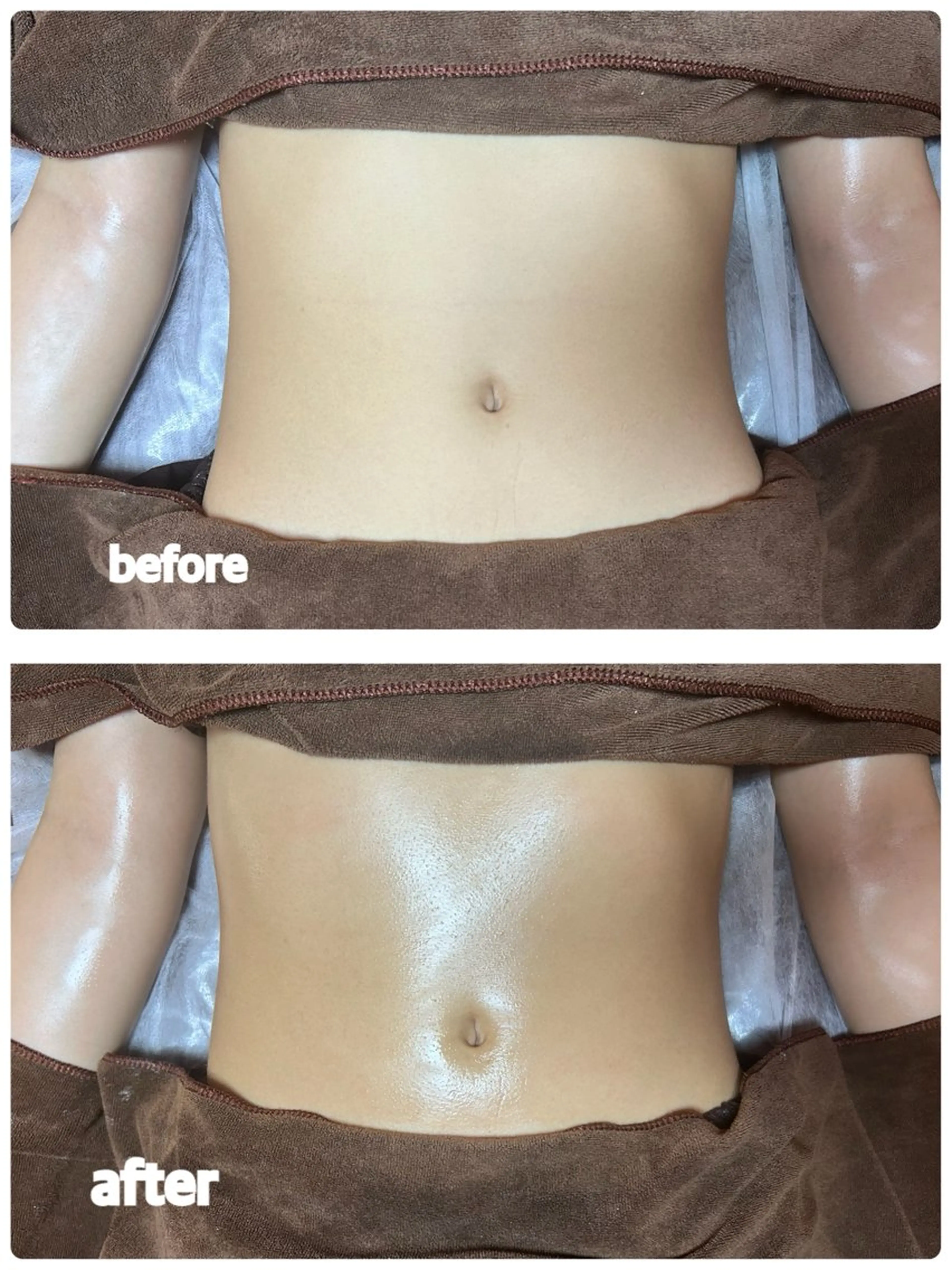 塩もみデトックス腸マッサージ60分の写真