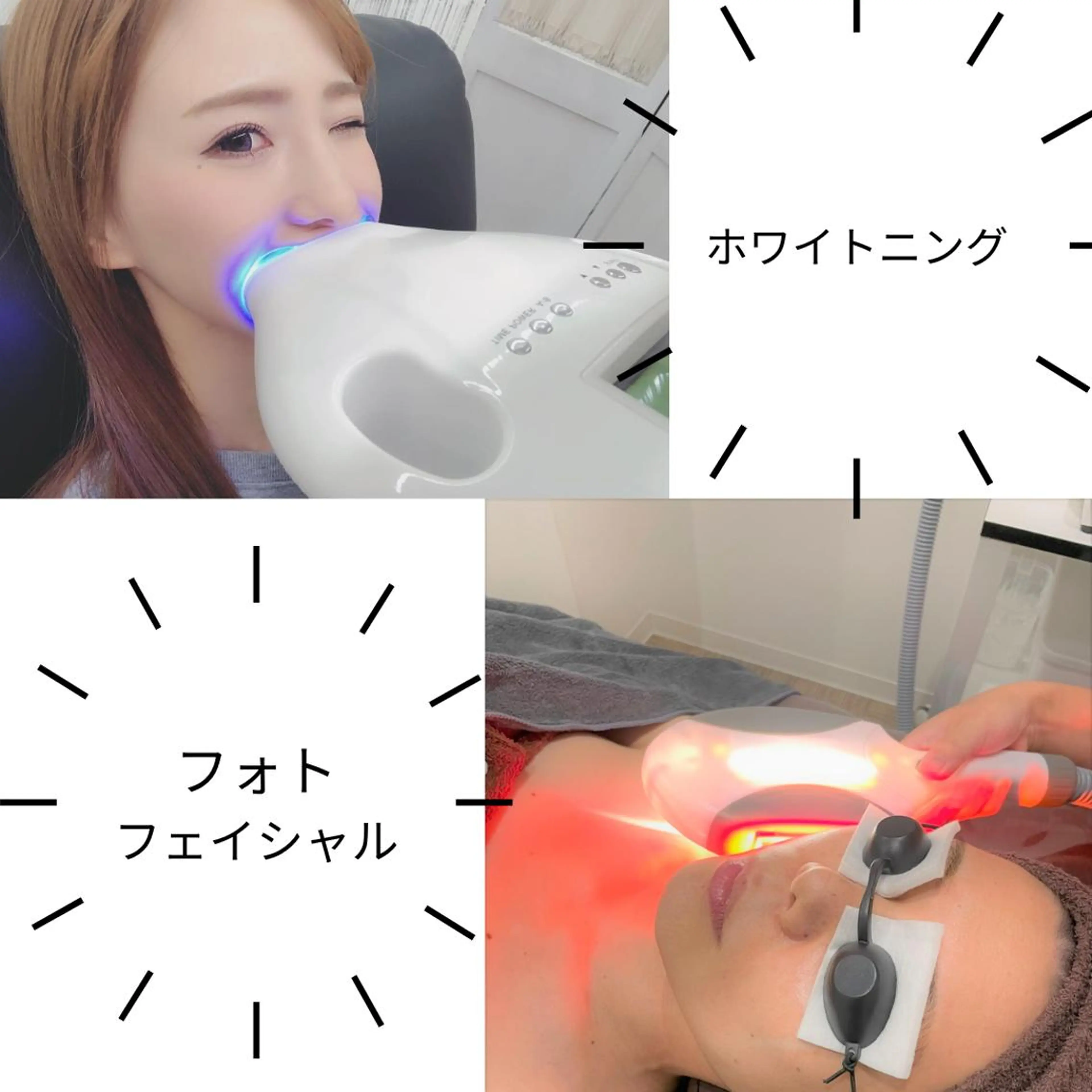 Twinkle White上尾店のエステ・リラクイメージ