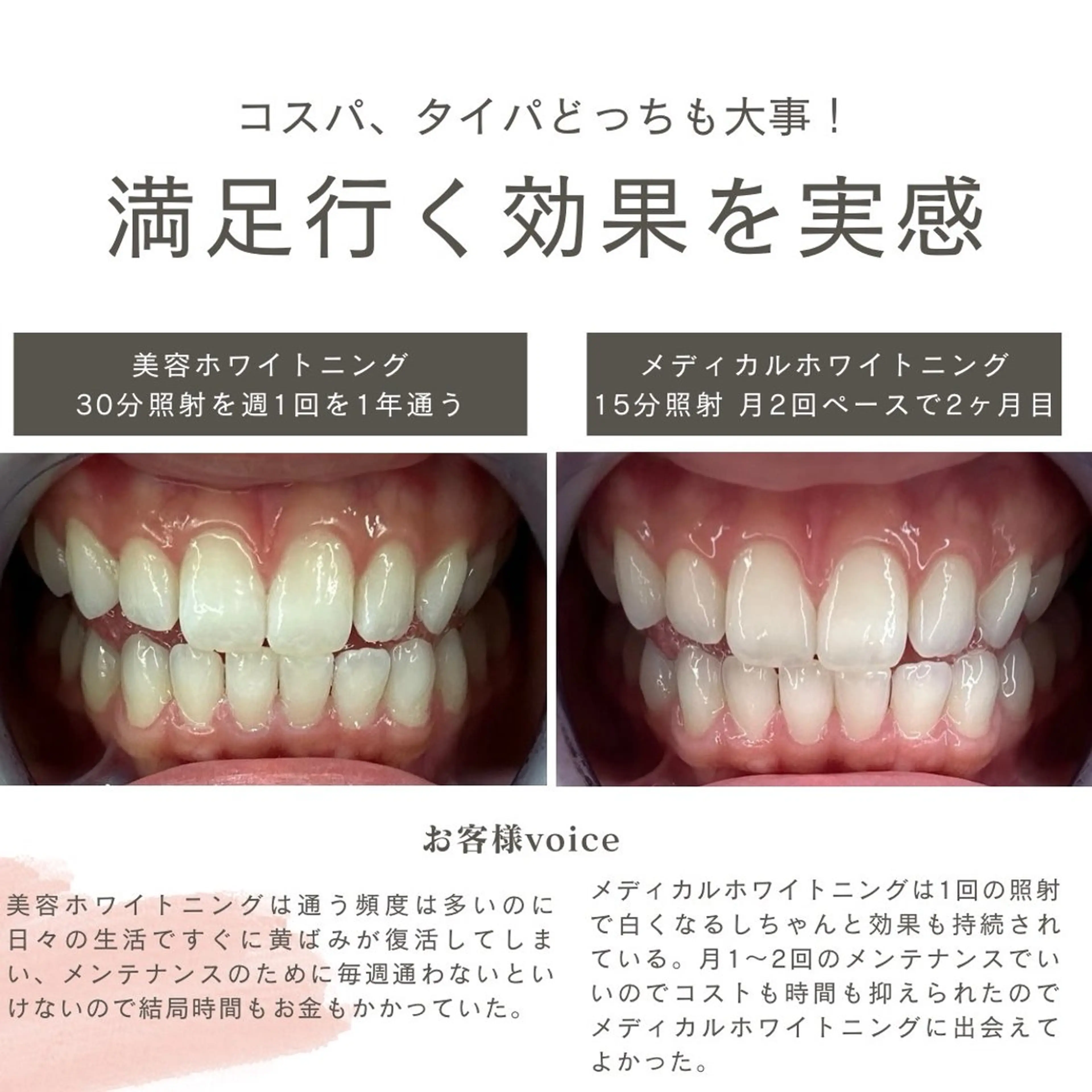 Whitening Carat 恵比寿店所属・ホワイトニング カラット 恵比寿店のエステ・リラクイメージ