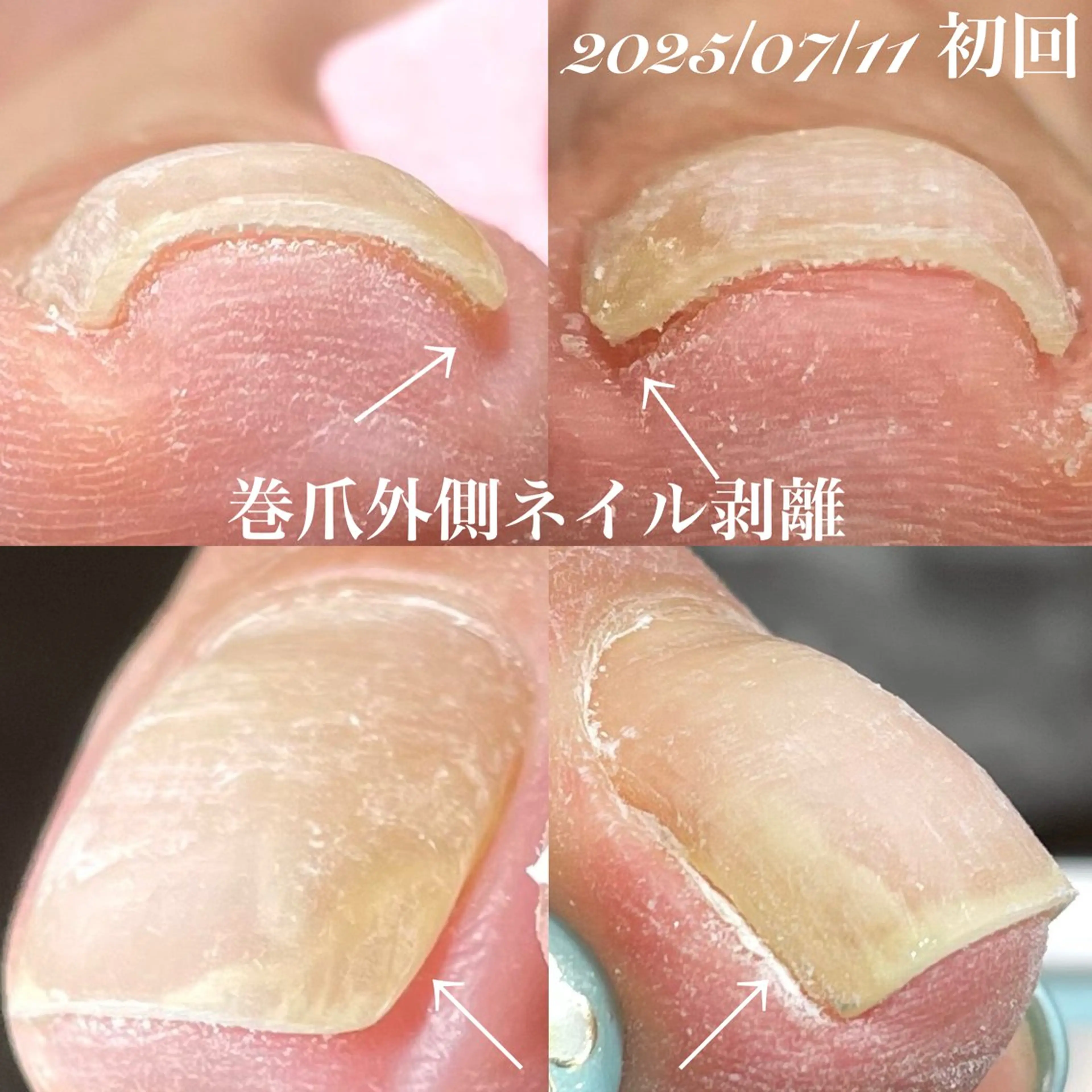 ネイル フットネイル 赤色 .Nails Mio 赤羽西ネイルサロンのネイルデザイン