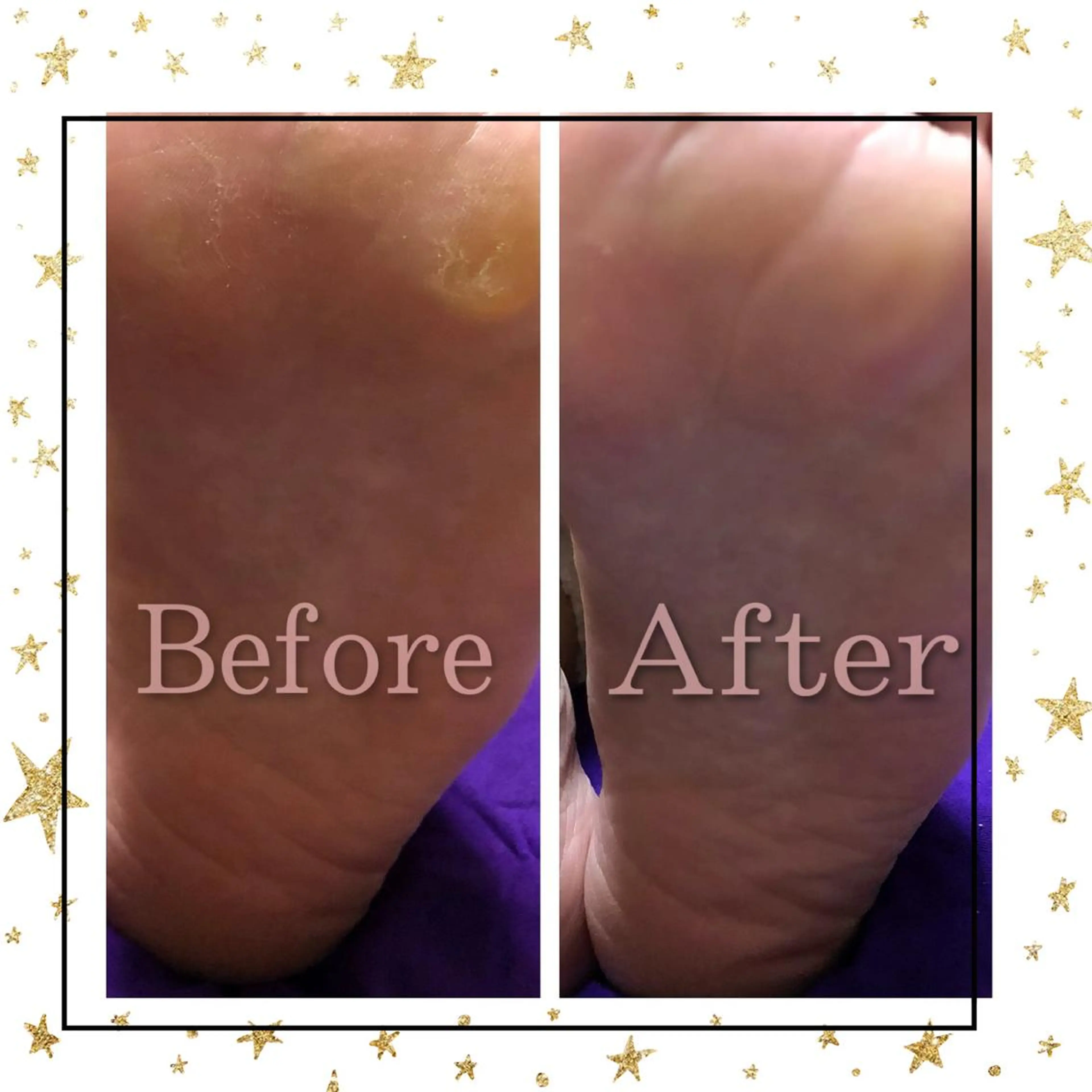 NAO 🌺のマツエク・マツパデザイン