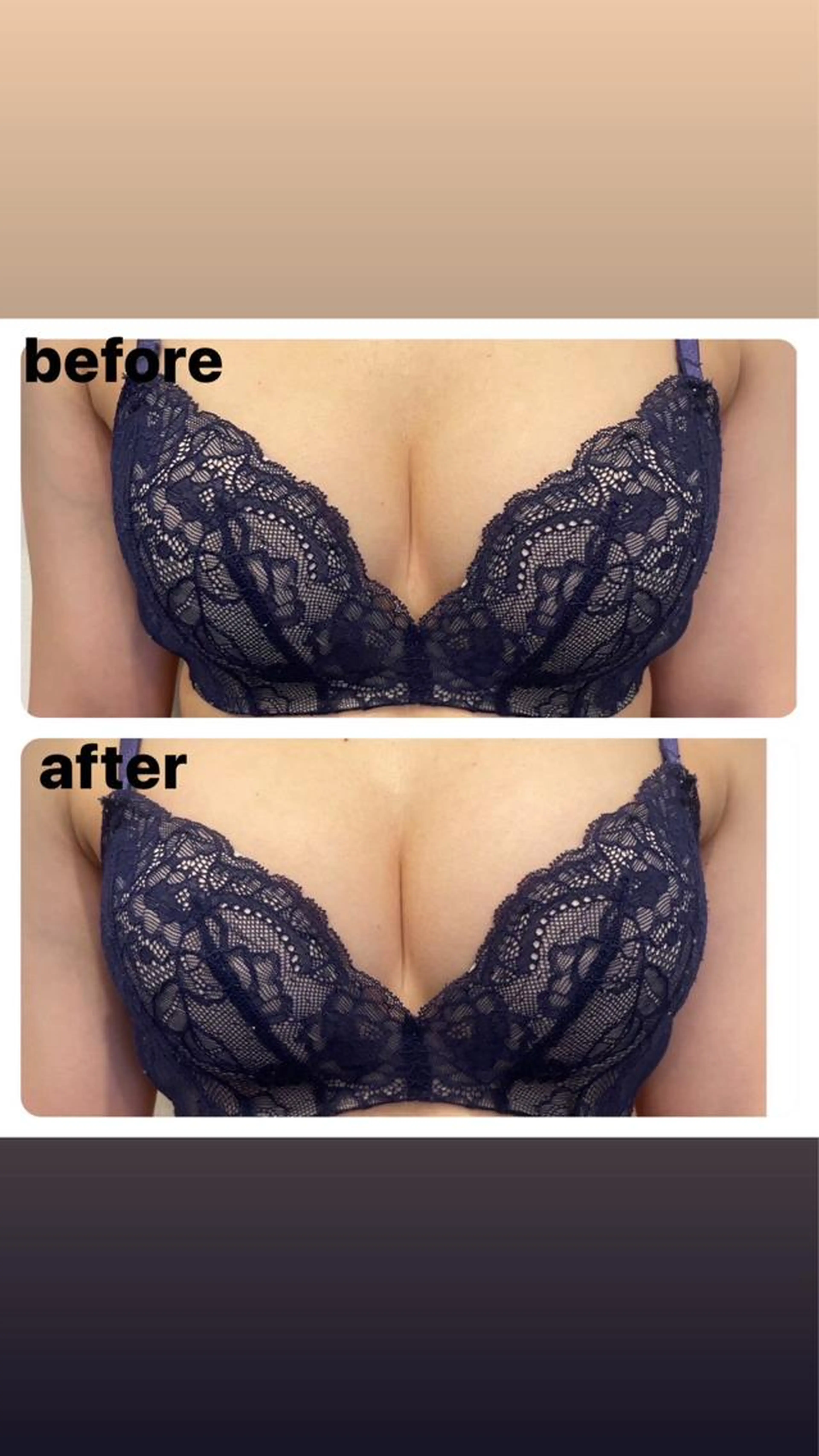 口コミ&モニター限定価格💕【20代】モテバストアップ痩身👙の写真