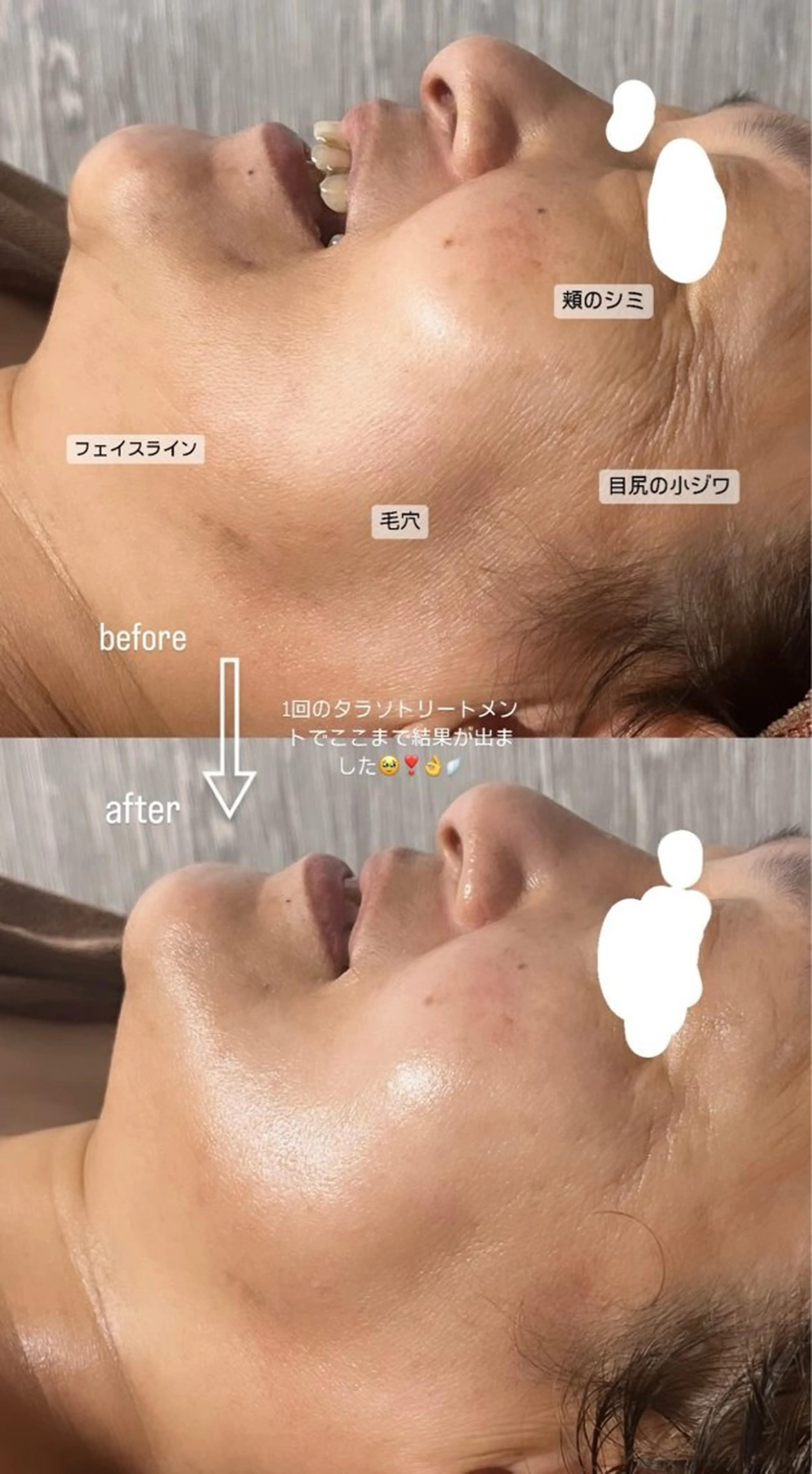 エステ Gypsend サロンドジプセンドのエステ・リラクイメージ