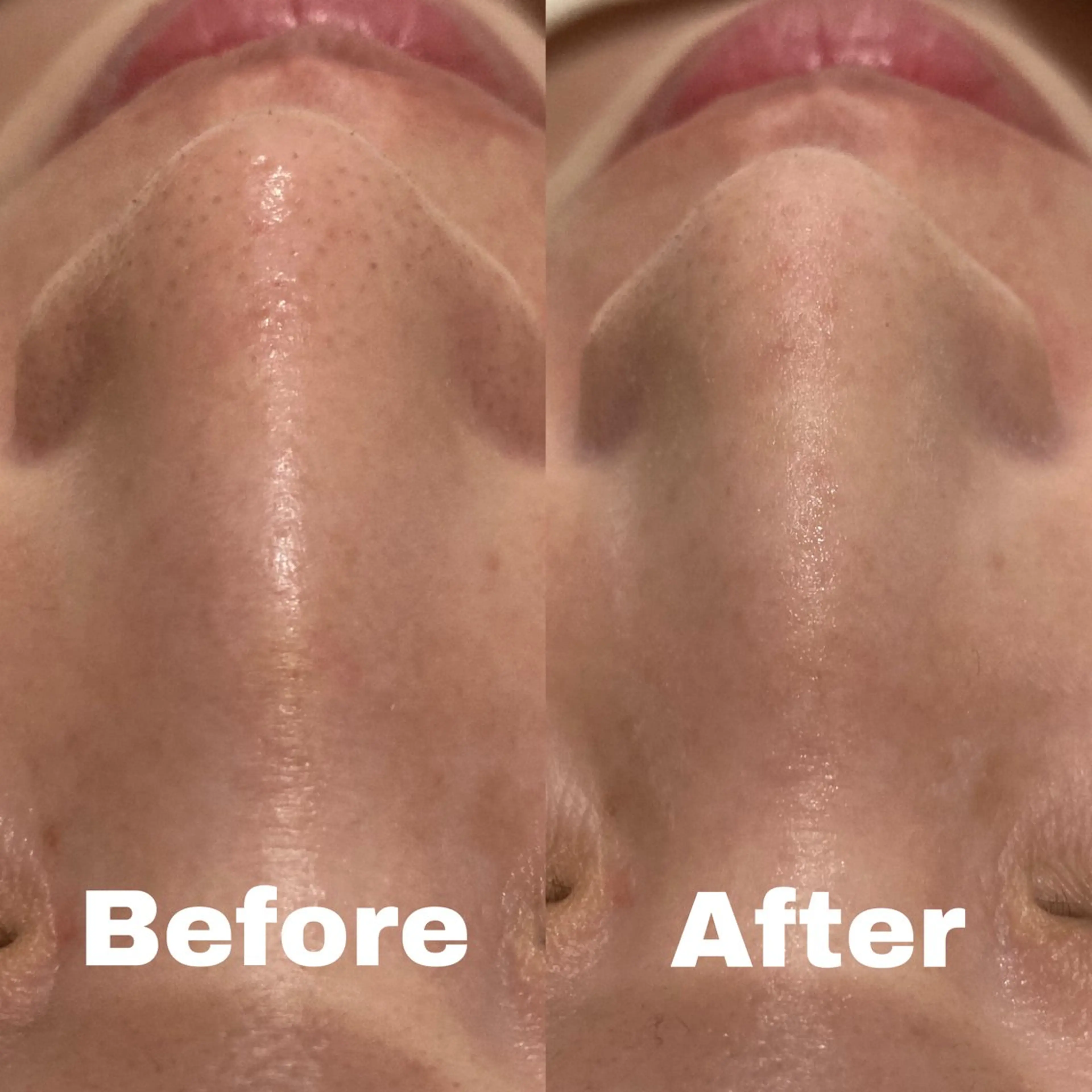 エステ NANI OAFU所属・NANIOAFU [なんば店］のその他イメージ