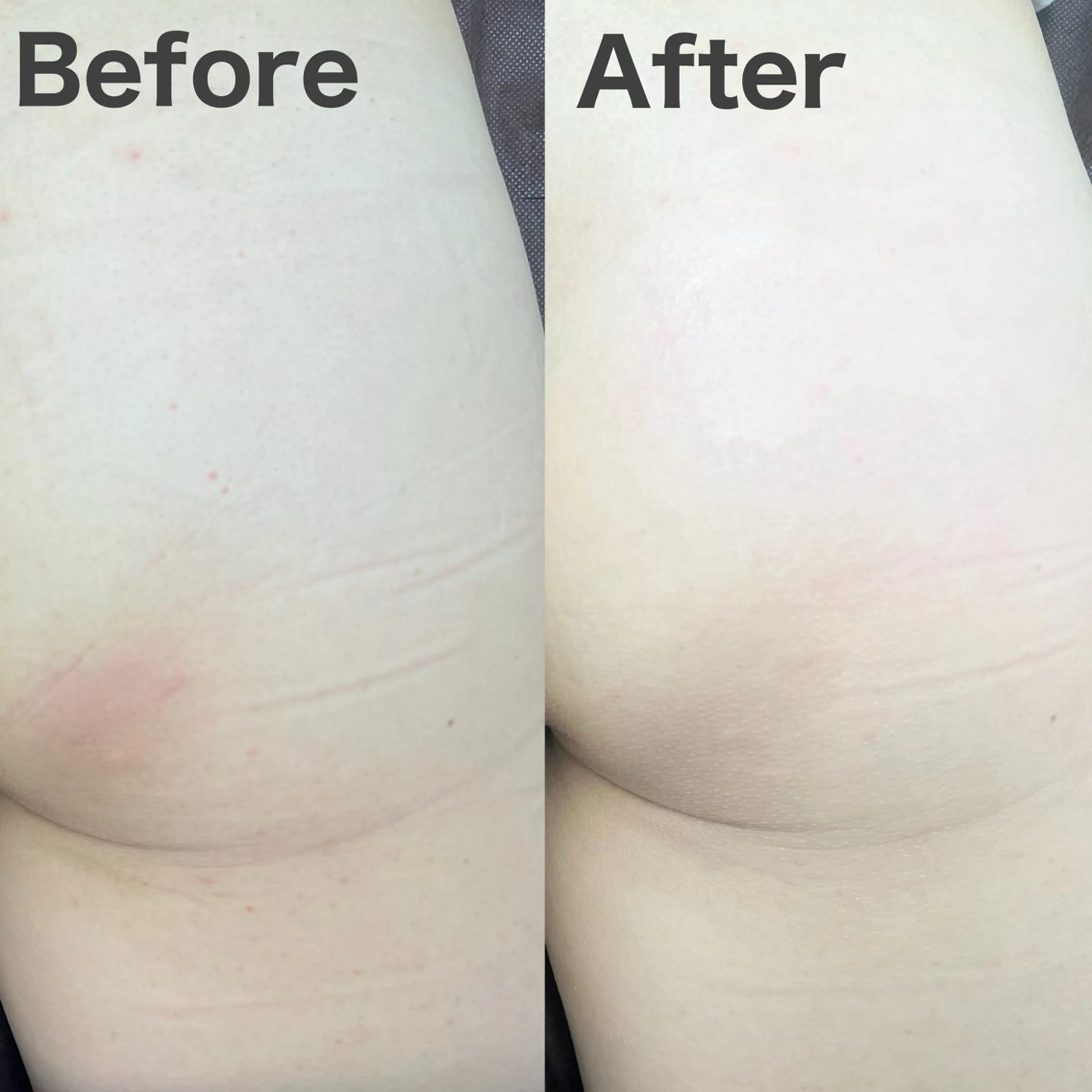 エステ プライベートサロン リプレイスのエステ・リラクイメージ