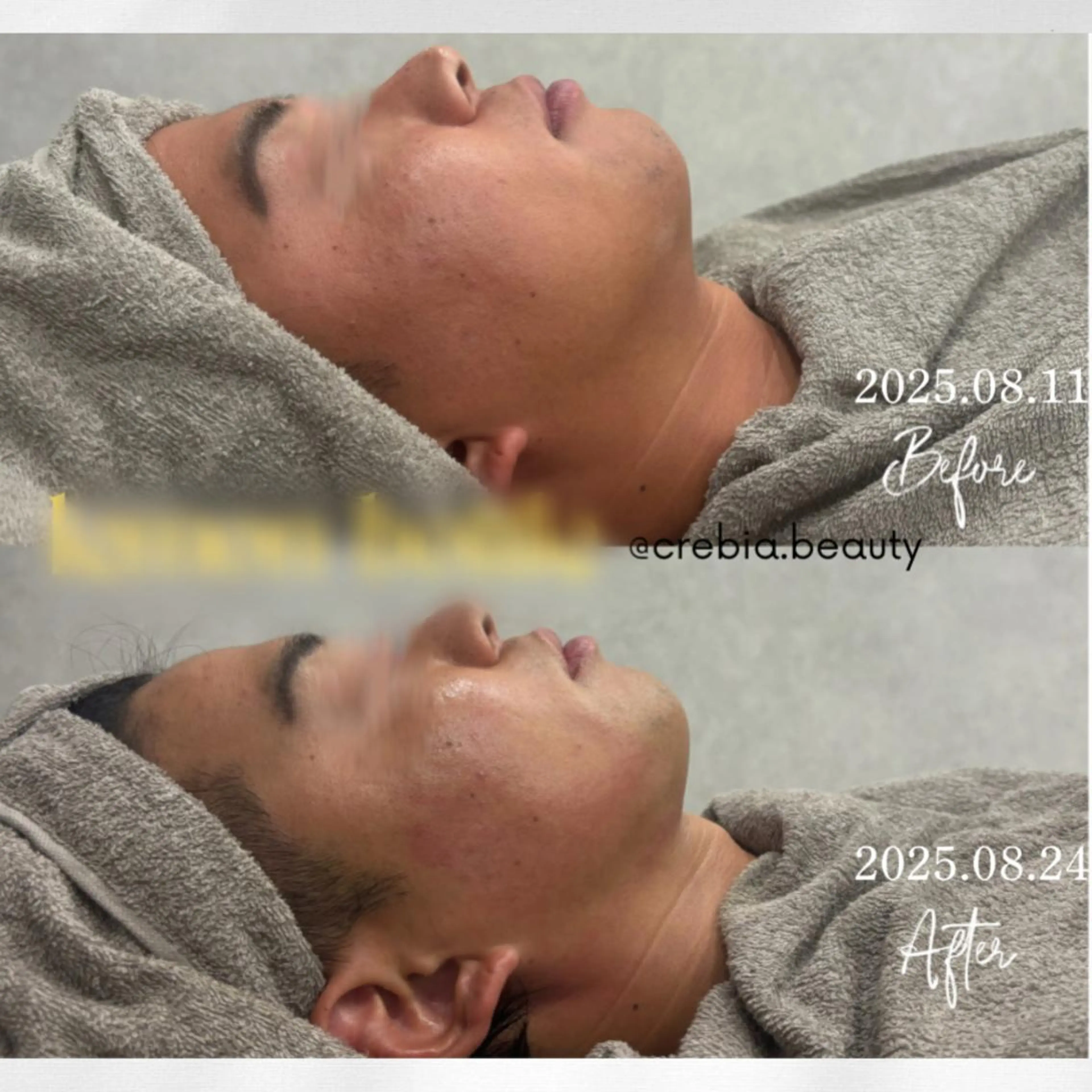 心斎橋🤍堀江.小顔 ハーブ.痩身クレビアのエステ・リラクイメージ