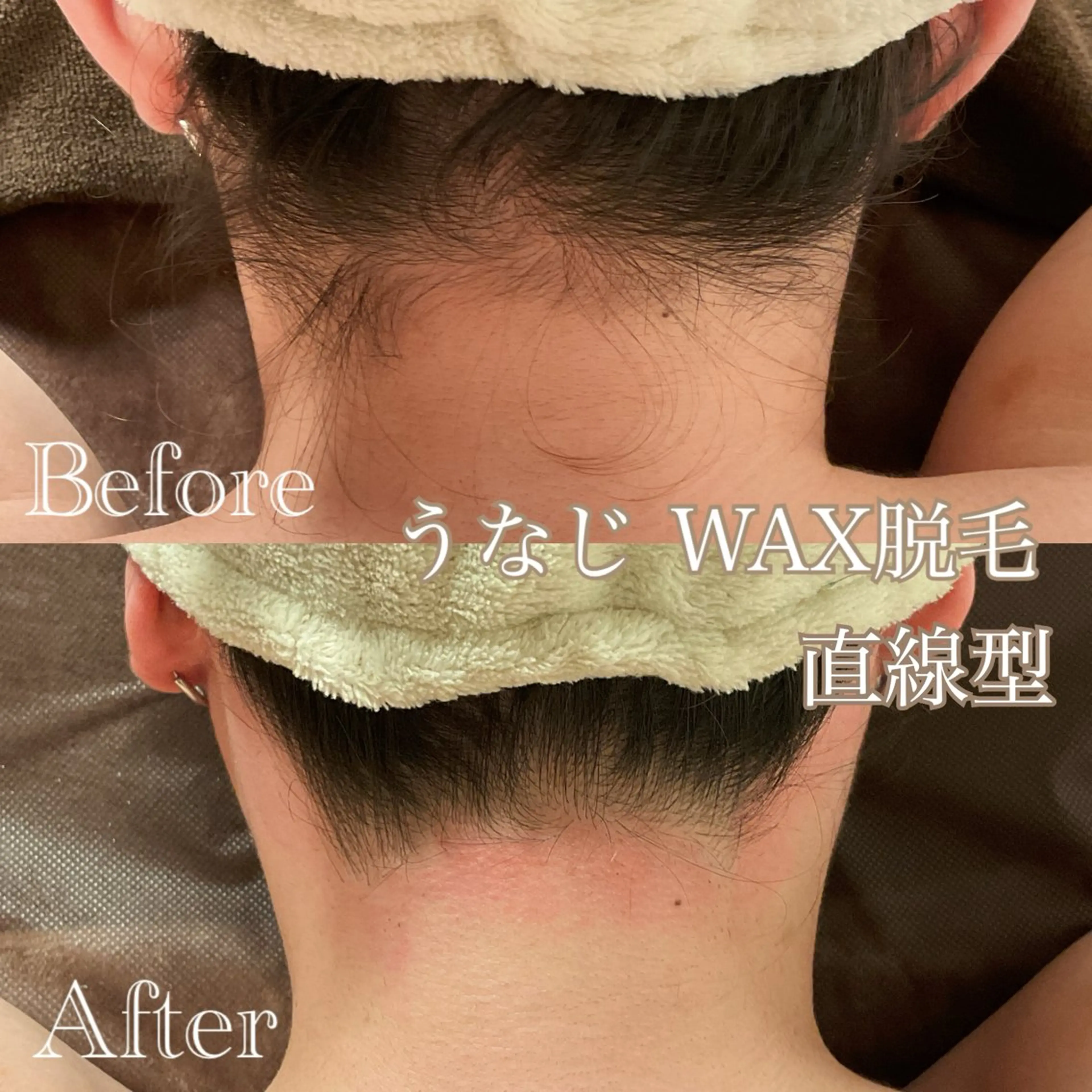 後ろ姿美人に♡WAXうなじ脱毛（¥2980）の写真