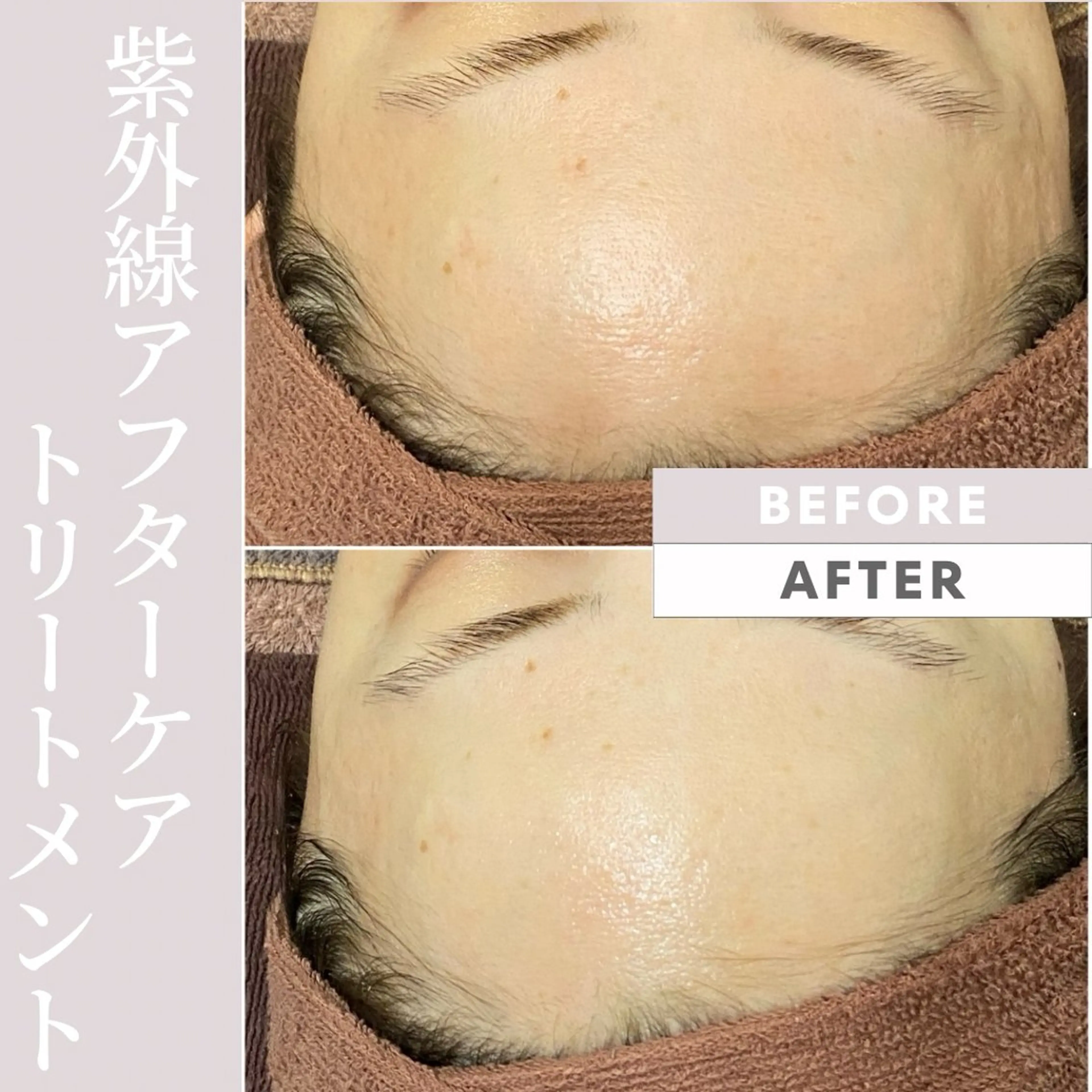 Purua beuty所属・月1肌管理 RINAのエステ・リラクイメージ