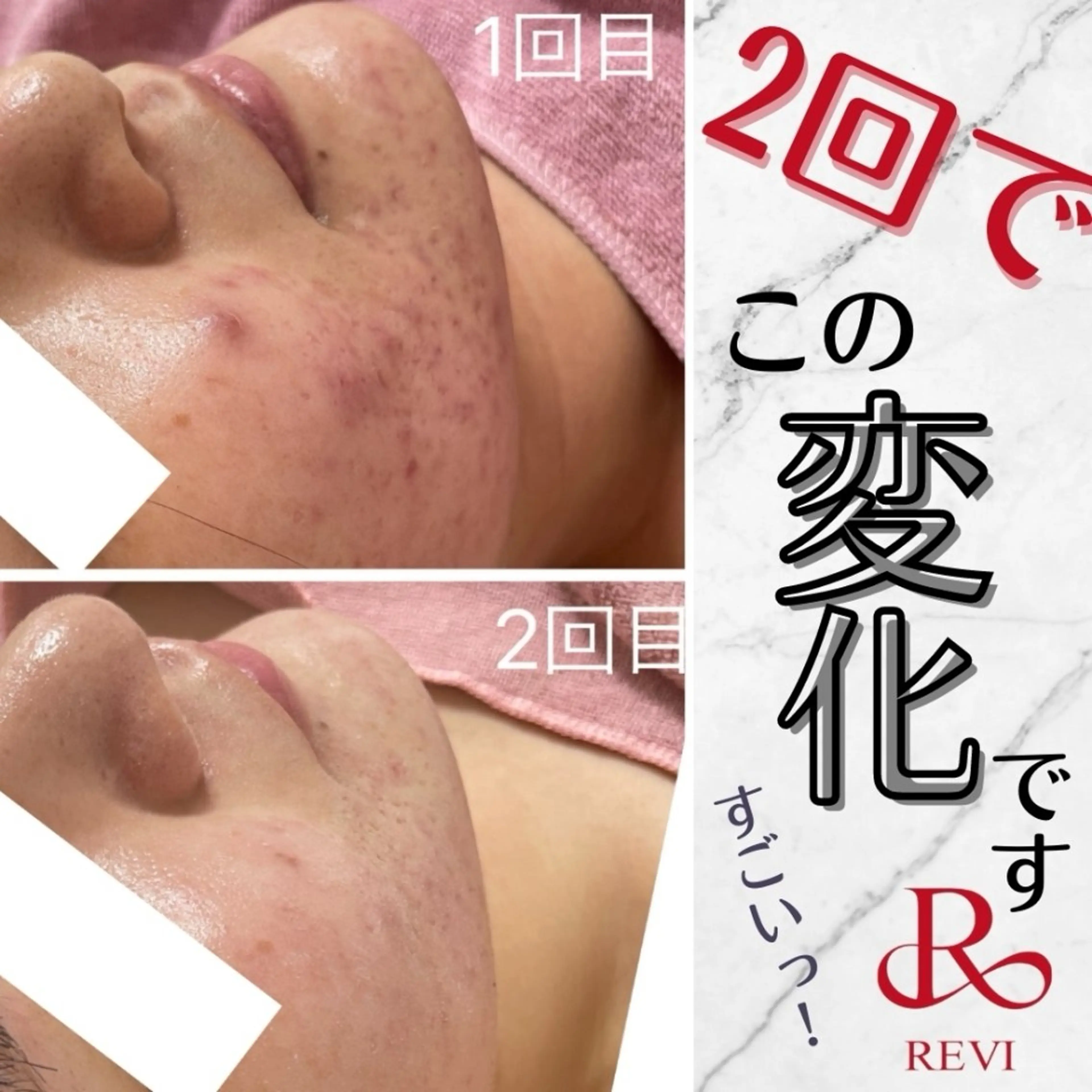 エステ Ange -viva la vida-所属・Ange vivalavidaのエステ・リラクイメージ