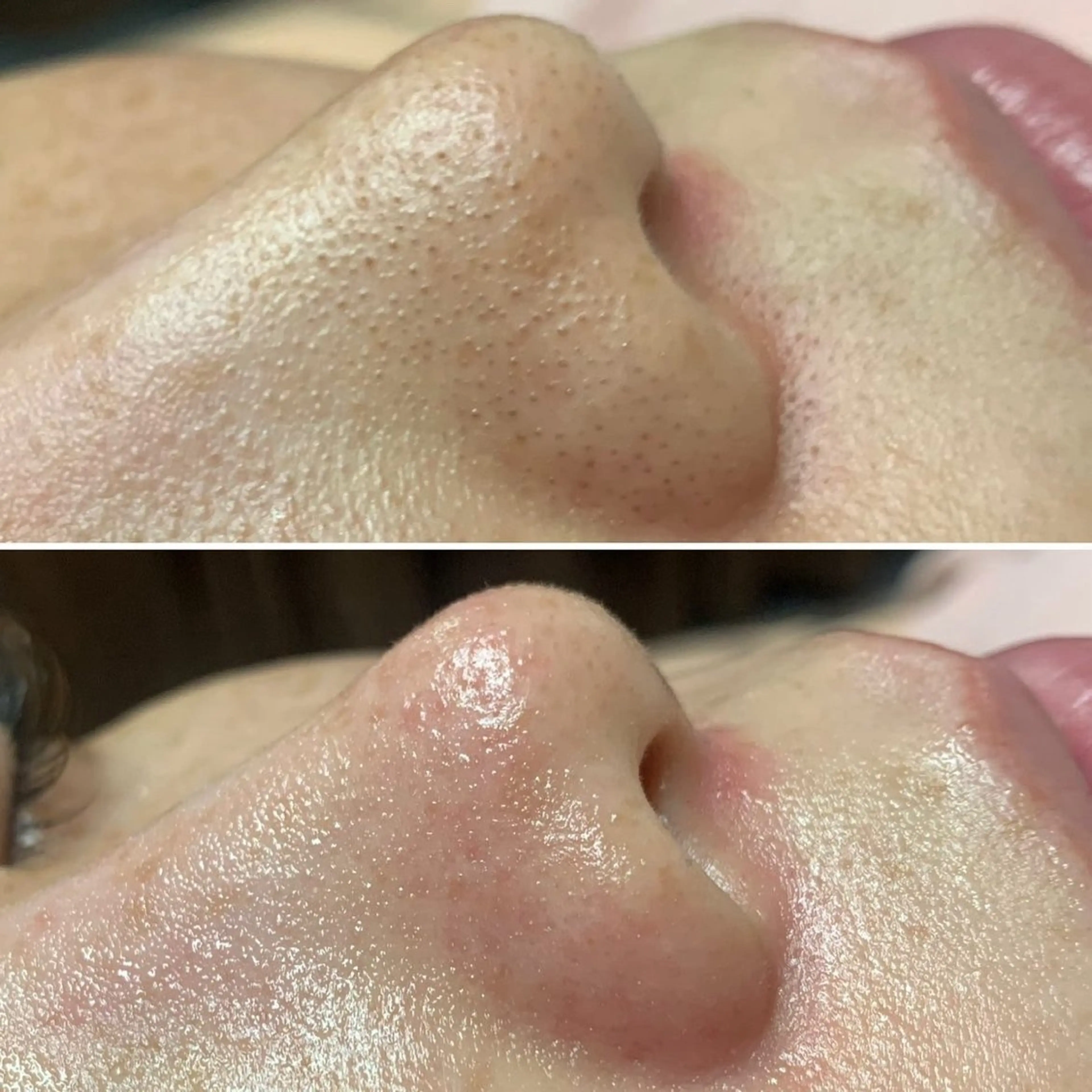 aroma  YURARI所属・韓国艶美人// 毛穴ケア🌹のエステ・リラクイメージ