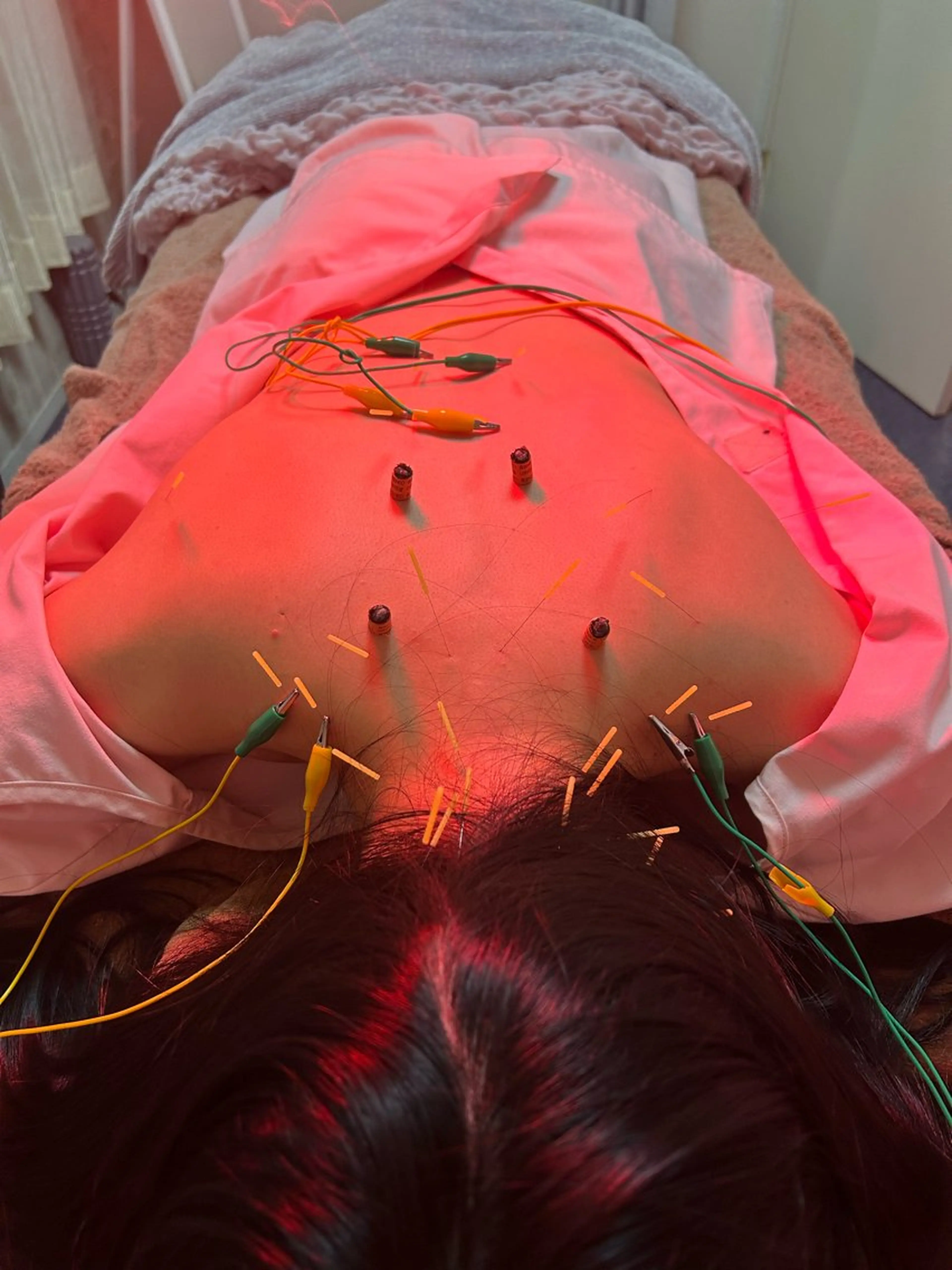 その他 美容鍼灸サロン mahoroba院長のエステ・リラクイメージ