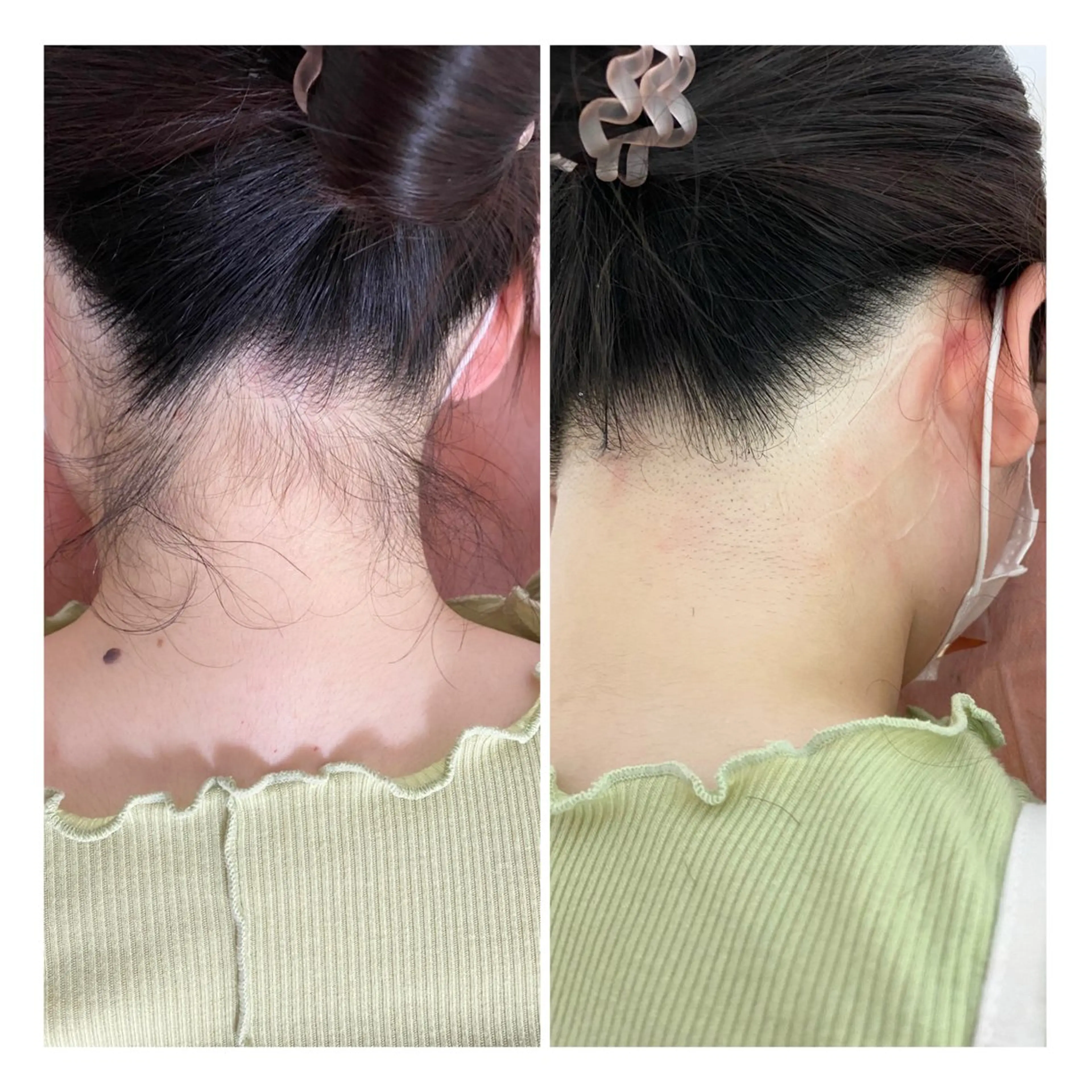 脱毛 美肌脱毛サロンGrande所属・別府脱毛サロン Grandeのエステ・リラクイメージ