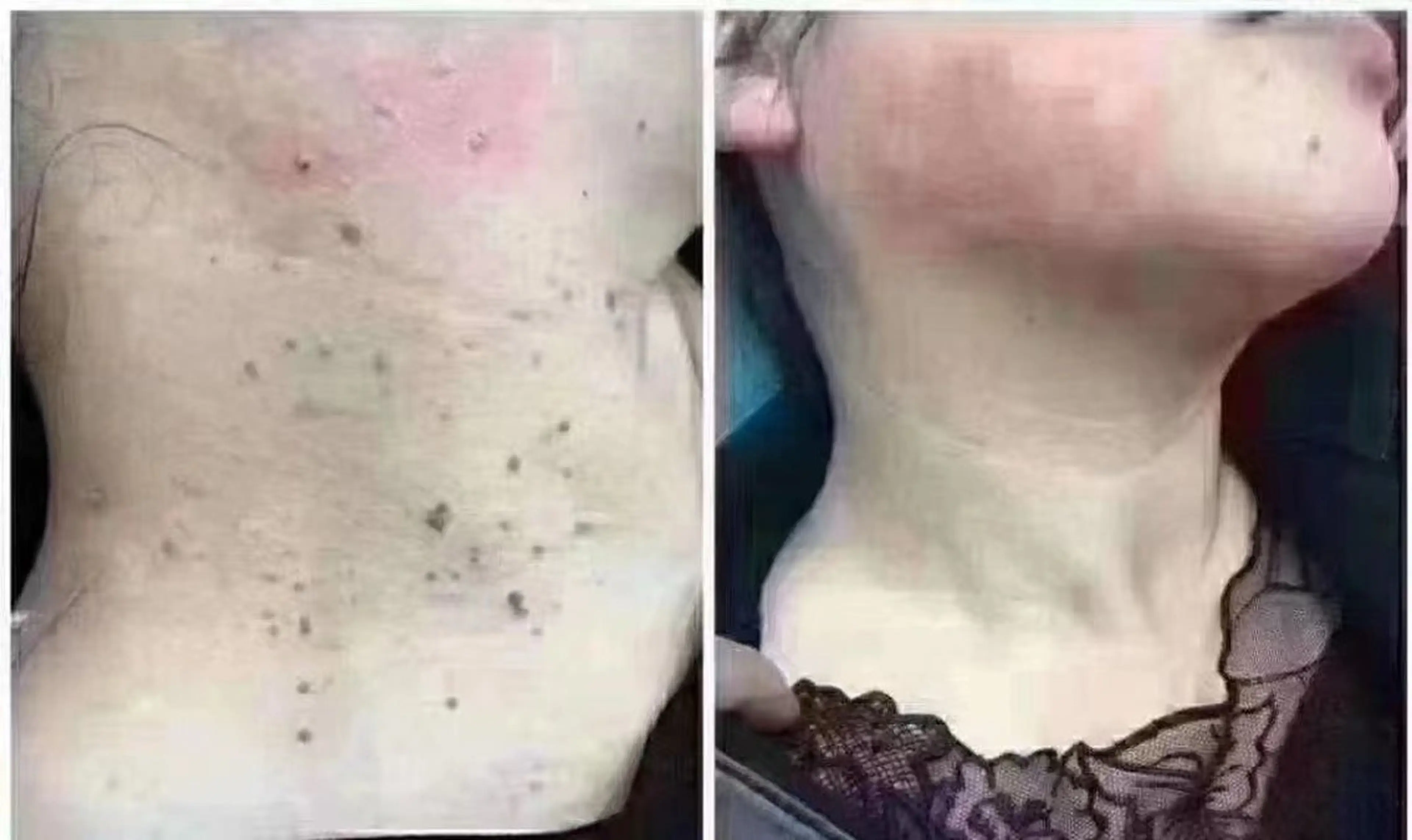 ビューティーリゾート麗所属・于 麗影のエステ・リラクイメージ