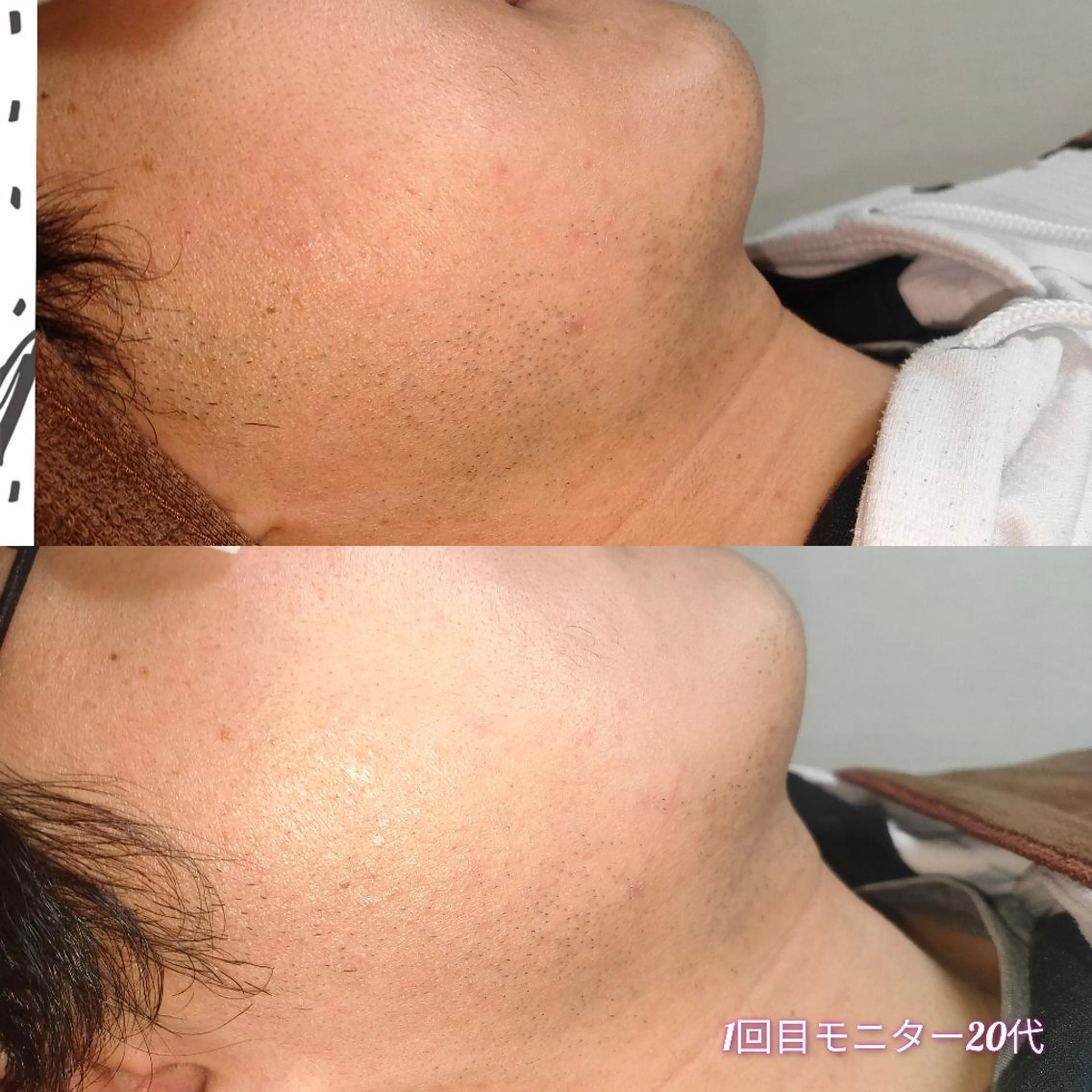 メンズ 脱毛 武 藤のエステ・リラクイメージ