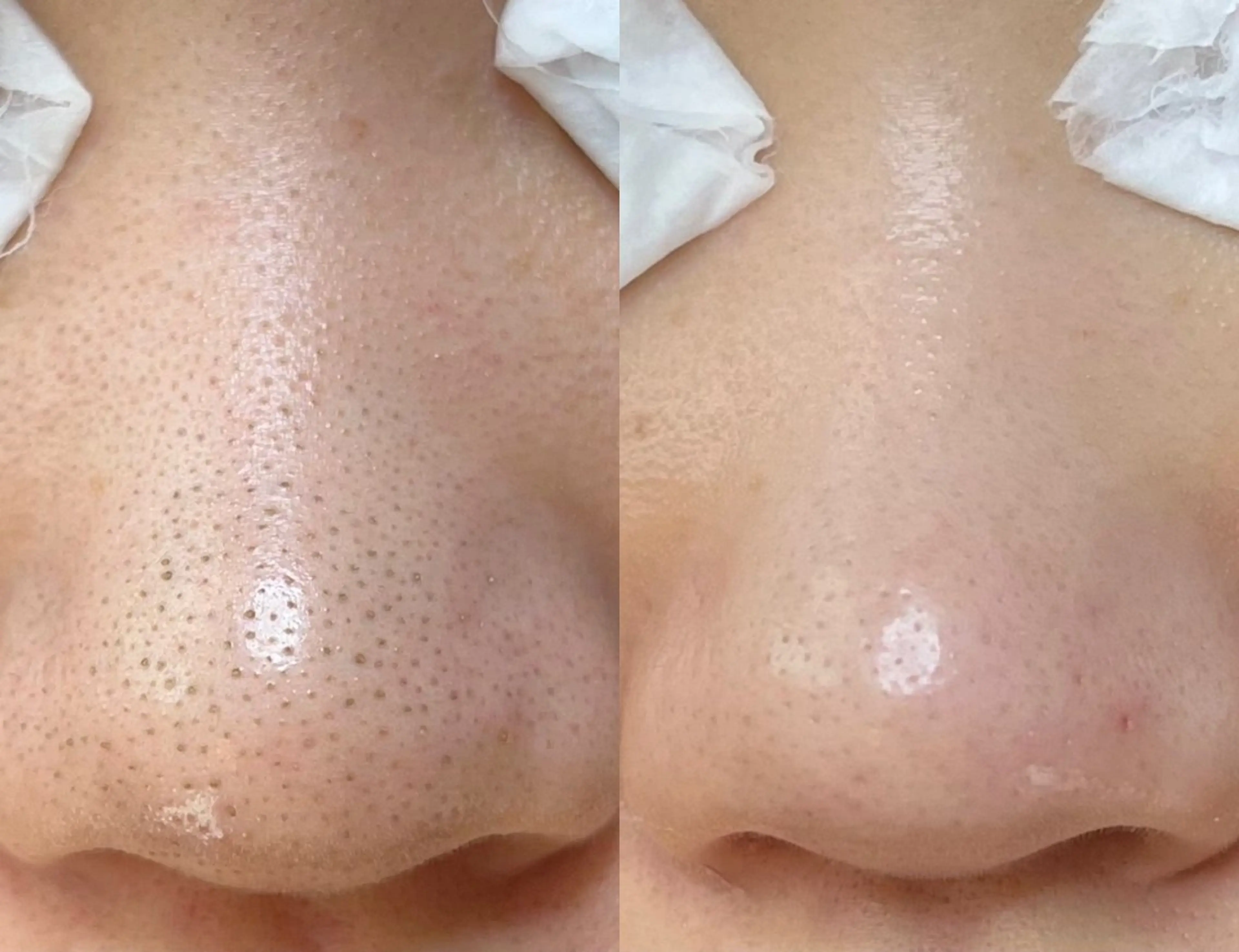 Lipula リプラ所属・毛穴ツヤ肌専門    Lipulaのエステ・リラクイメージ