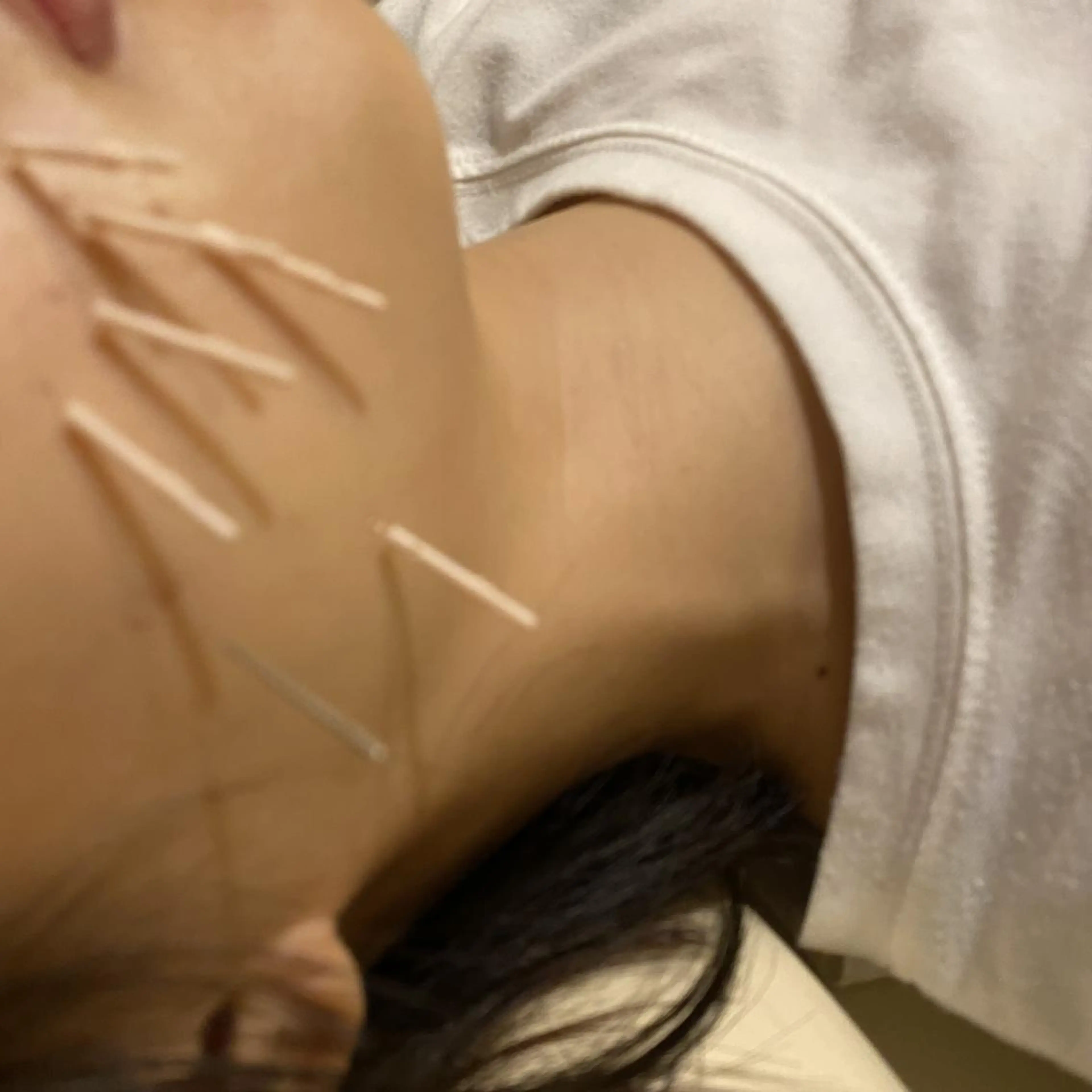 むくみたるみ専門☆ 美容鍼・小顔矯正のエステ・リラクイメージ