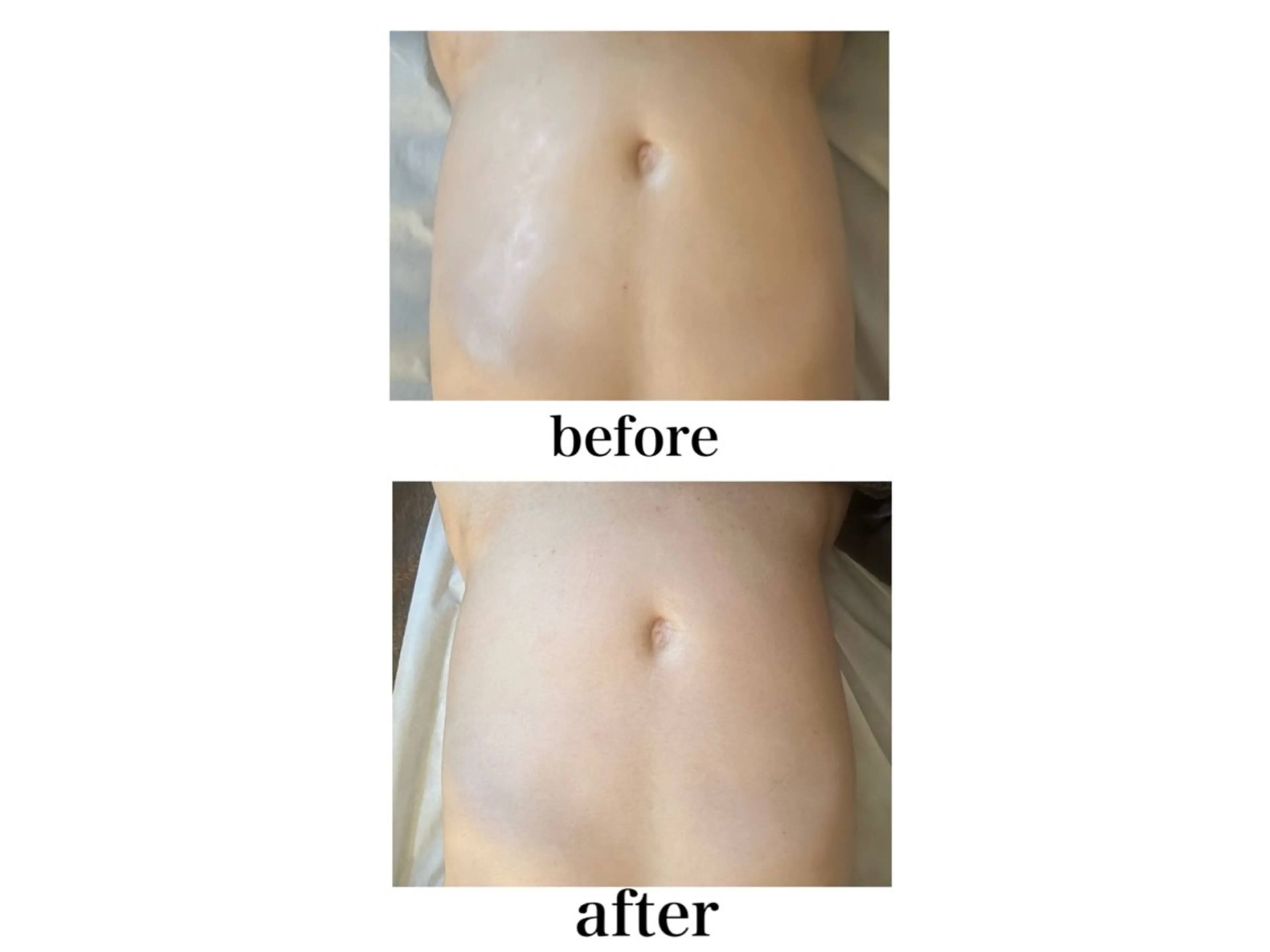 全身☆ヒートファジー✨[むくみ改善、免疫力アップ]足湯付き60分の写真