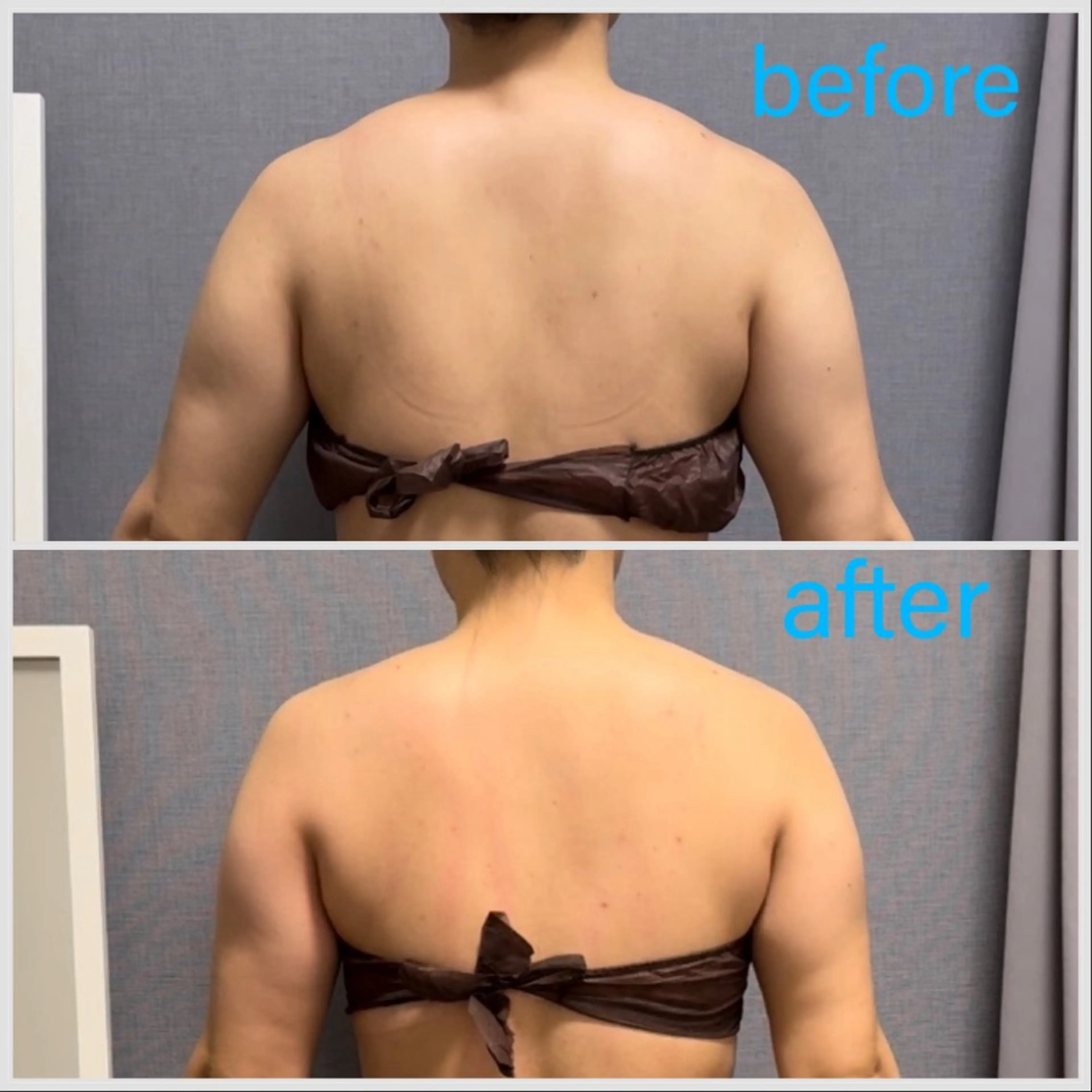 【ガチガチの凝り、筋肉の張りと疲れを撃退！！】asami式リンパ60分上半身体験コース✨の写真