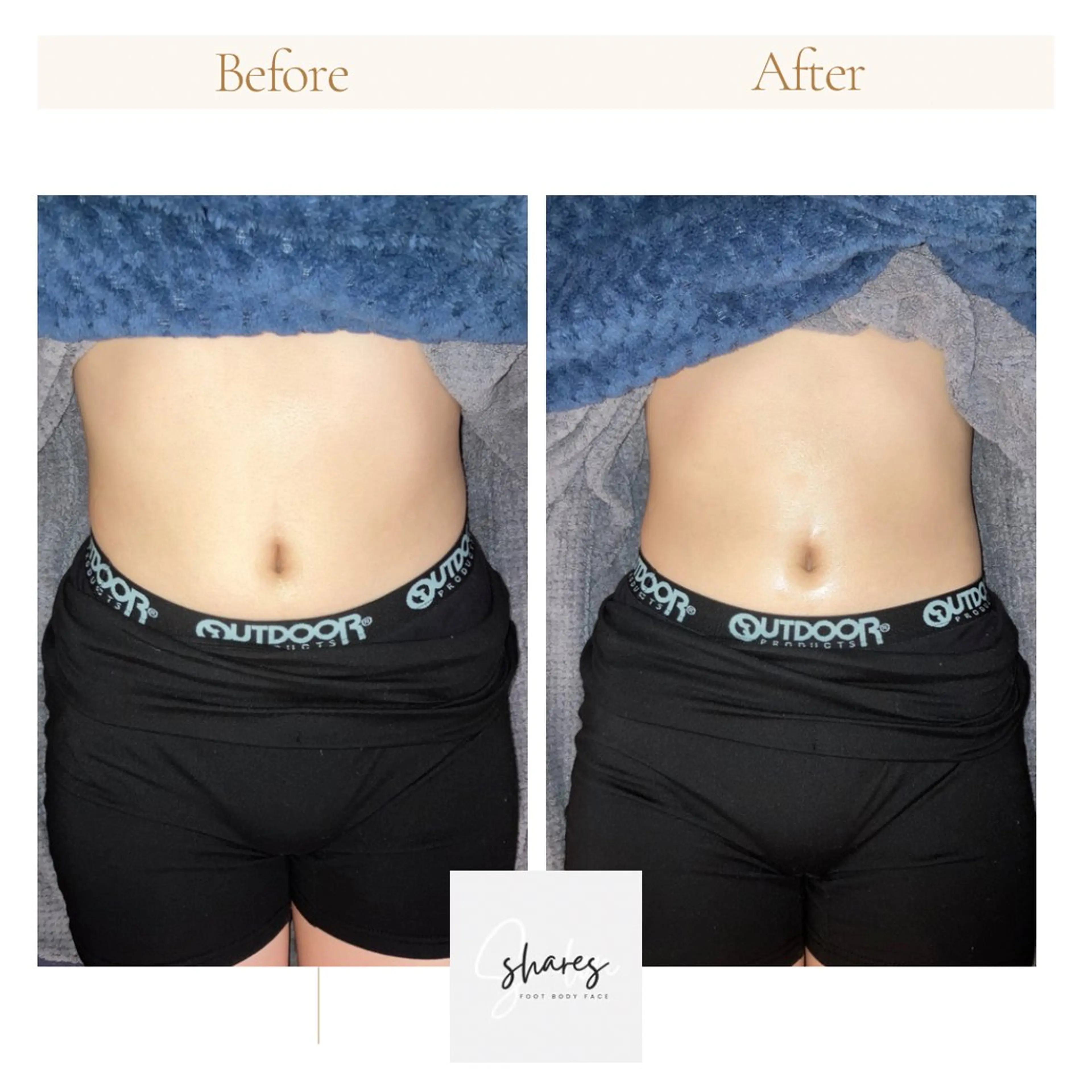 shares saayaのエステ・リラクイメージ