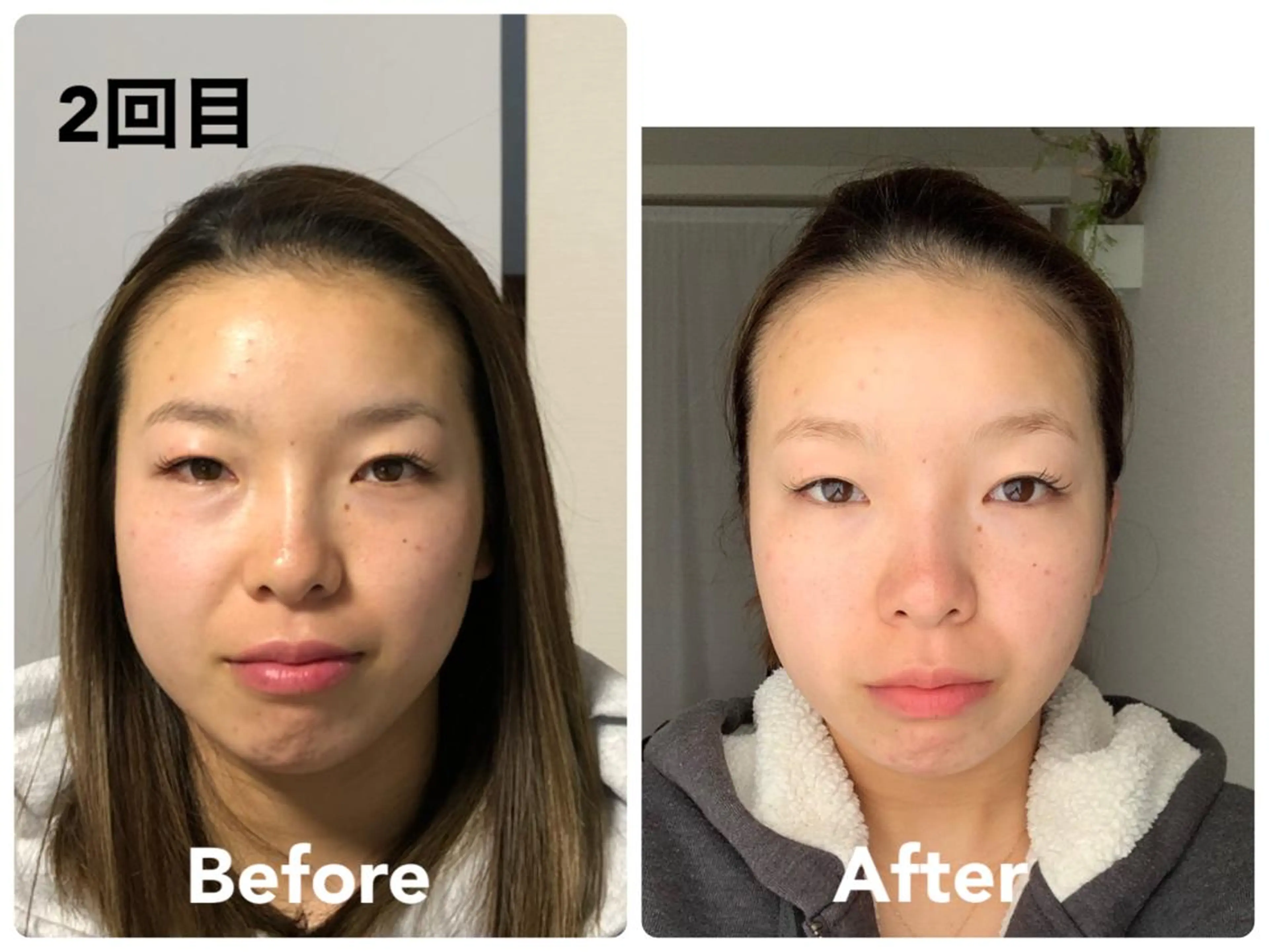 スターローズ所属・小顔矯正サロン スターローズのエステ・リラクイメージ