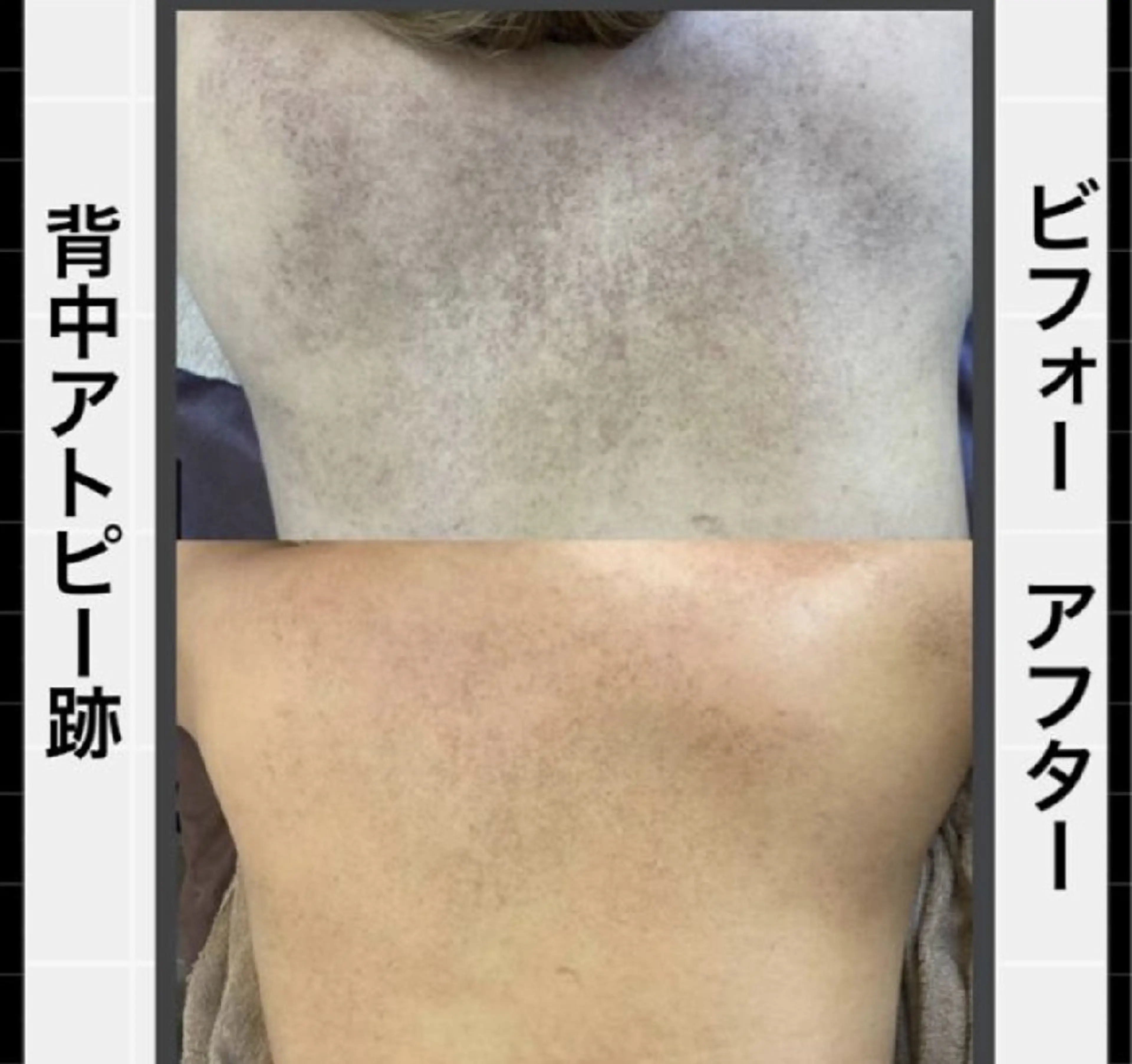 エステ ハーブピーリング専門 COCO.梅田中津のエステ・リラクイメージ